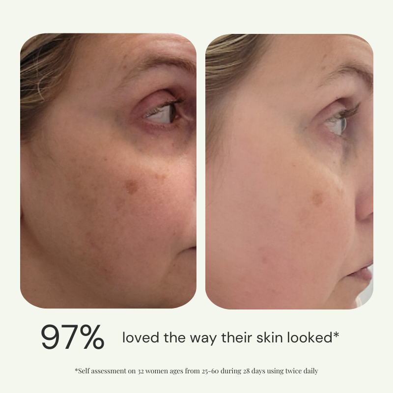 Emani Sleep & Renew Serum før og etter - www.Hudonline.no