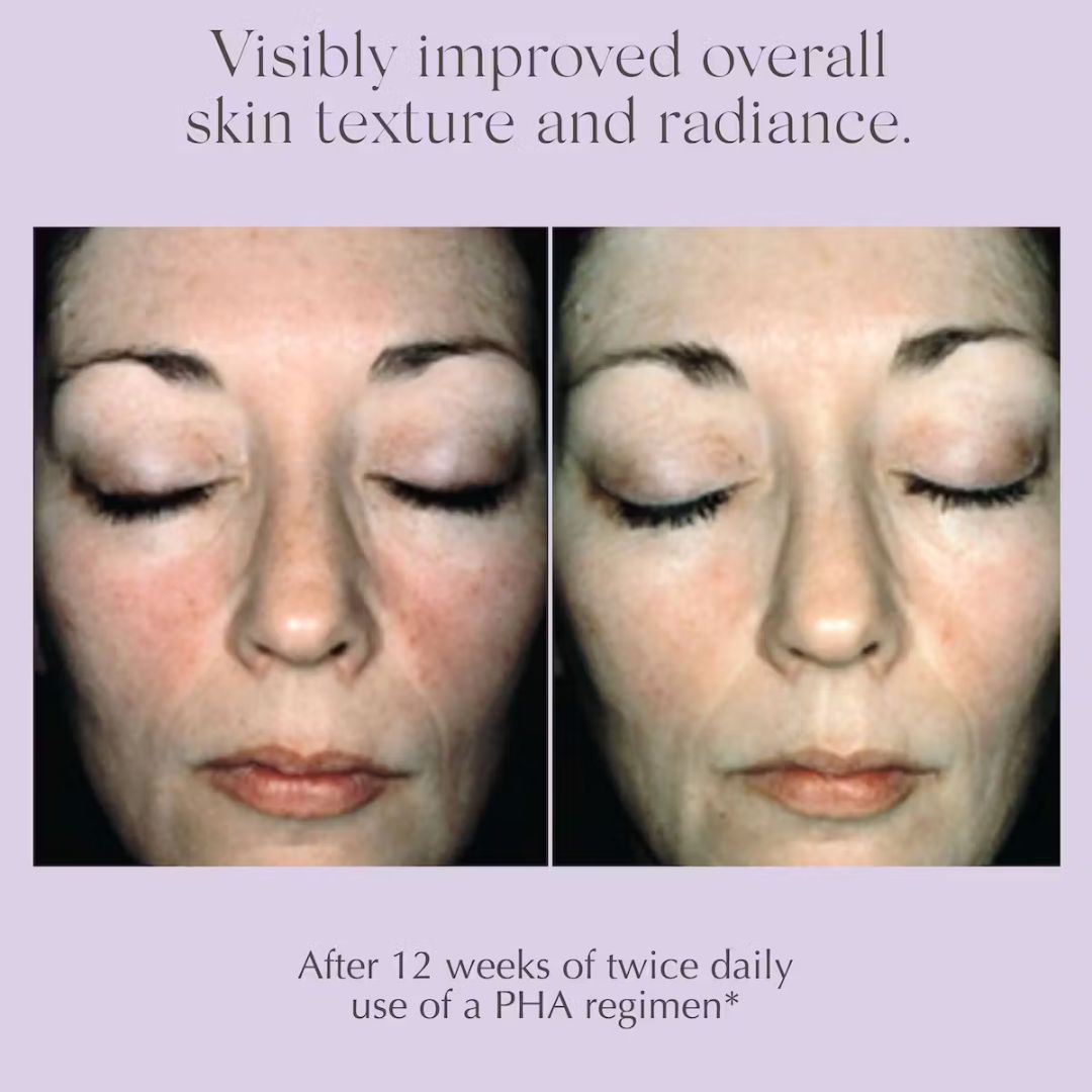 Exuviance Overnight Transformation complex - www.Hudonline.no