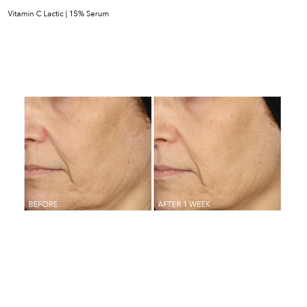 Dennis Gross 15% vitamin c firm & bright serum - www.Hudonline.no