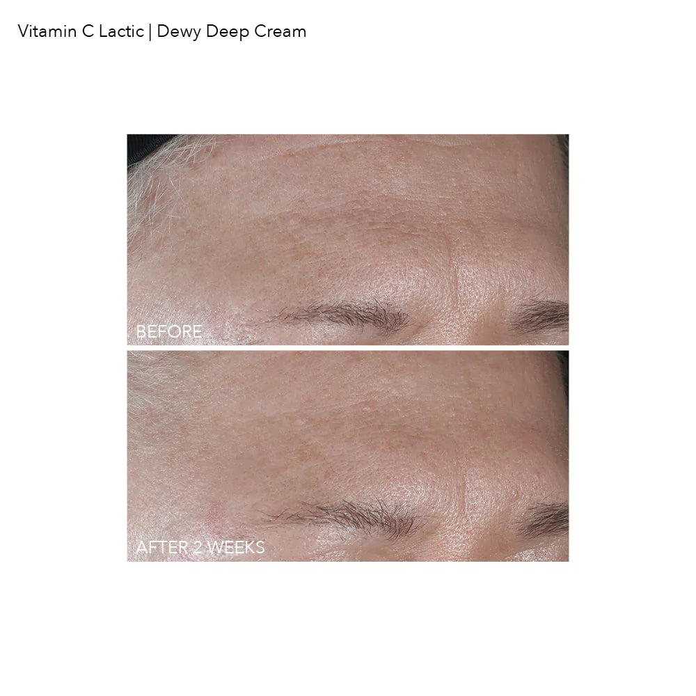 Dennis Gross Vitamin C + Lactic Dewy Deep Cream - www.Hudonline.no 