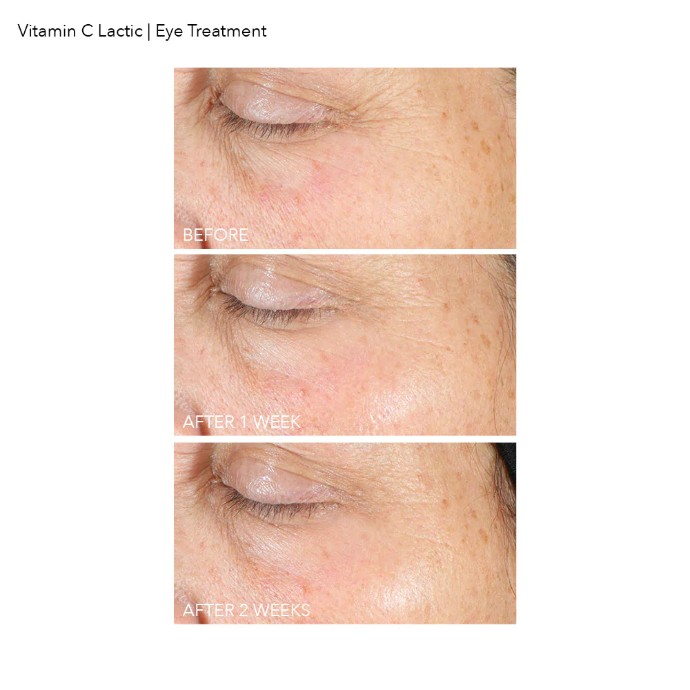 Dennis Gross Vitamin C + Lactic Firm & Bright Eye Treatment - www.Hudonline.no