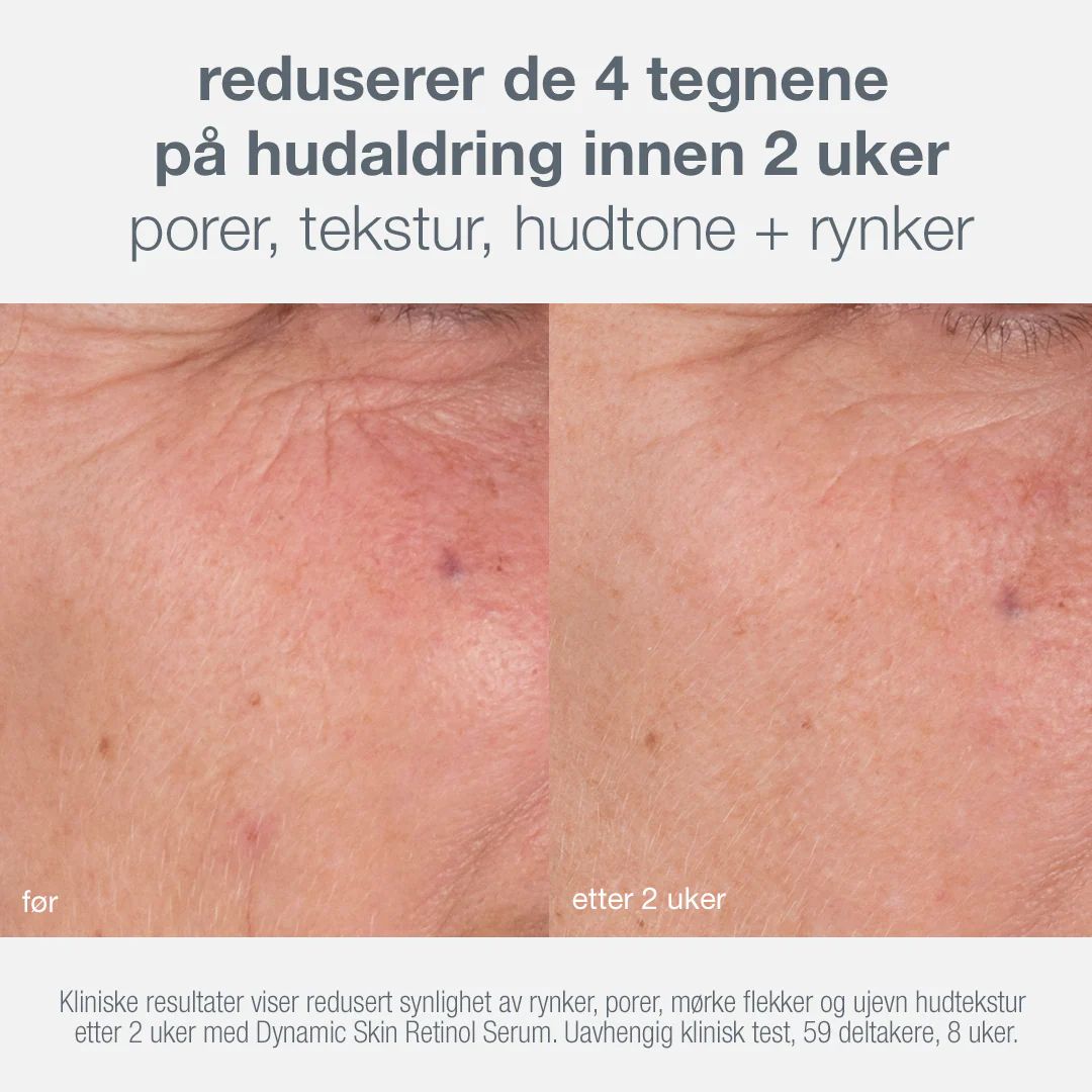Dermalogica Skin Kit - Age Defense - www.Hudonline.no 