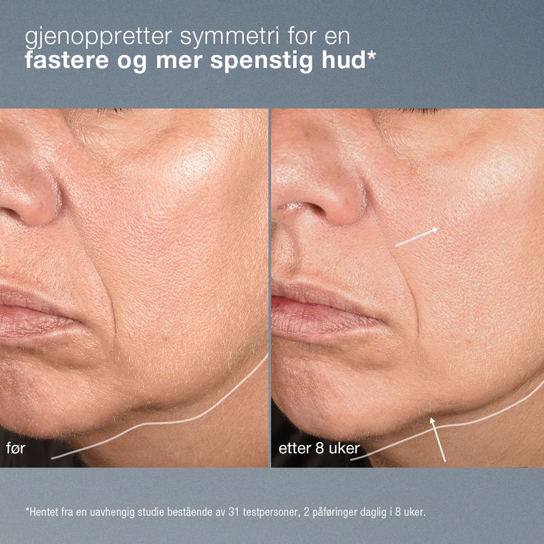 Dermalogica Neurotouch Symmetry Serum 30 ml - www.Hudonline.no 