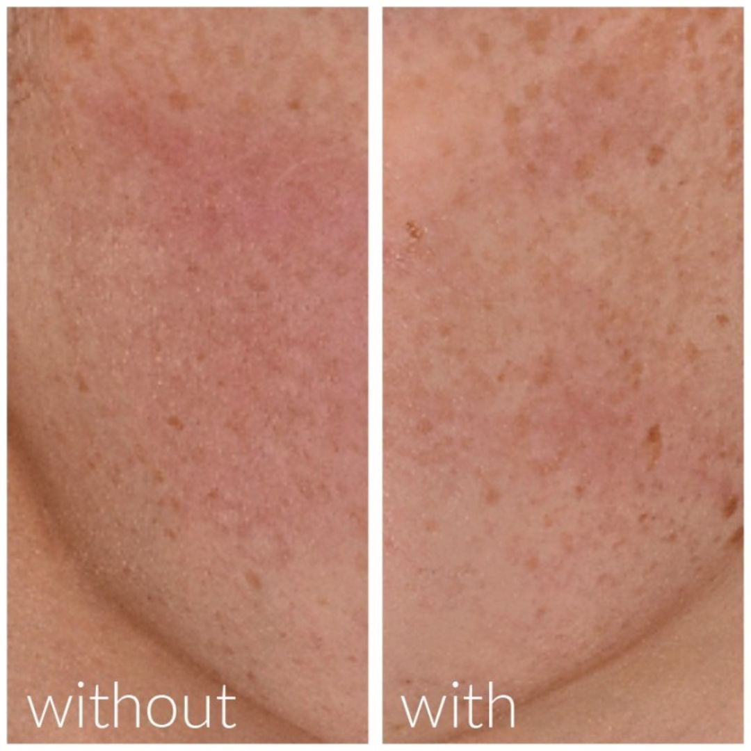 MD Skin Solutions Meso´Me Optimizer 30 ml - www.Hudonline.no 