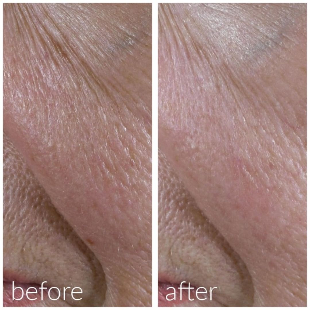 MD Skin Solutions Meso´Me Radiance 20 ml - www.Hudonline.no 