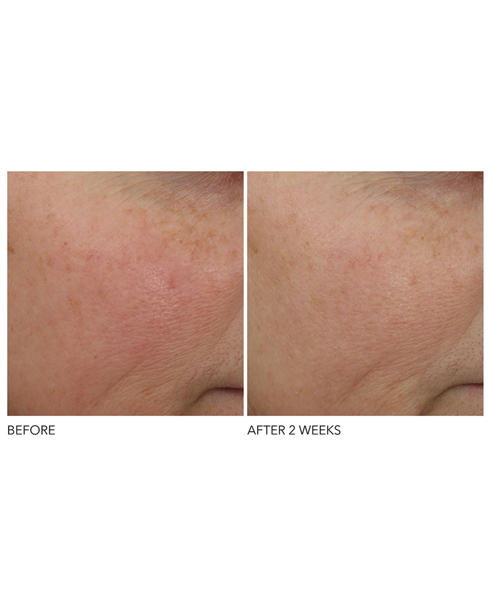 Dr Dennis Gross Advanced Retinol + Ferulic Wrinkle Repair Sett - www.Hudonline.no