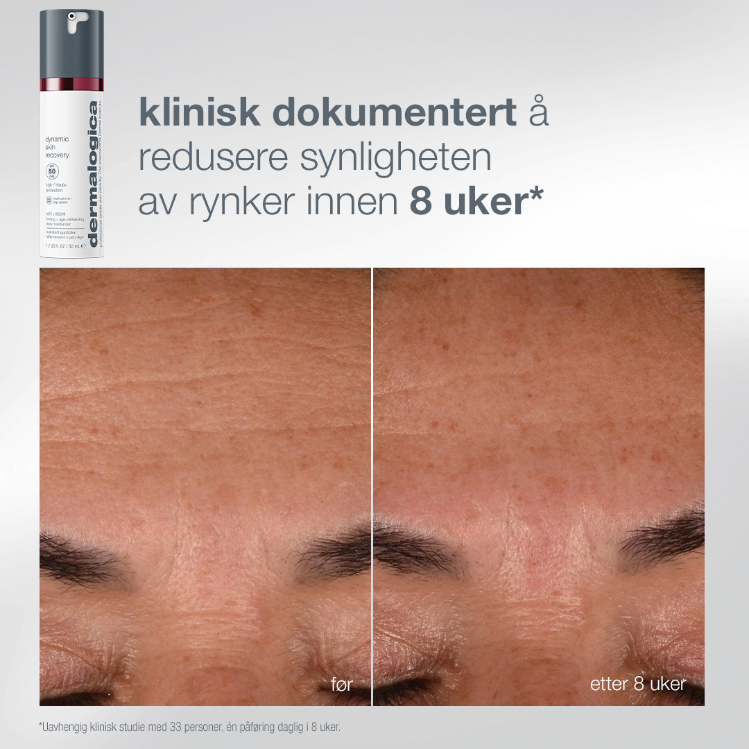 Dynamic Skin Retinol Serum før og etter