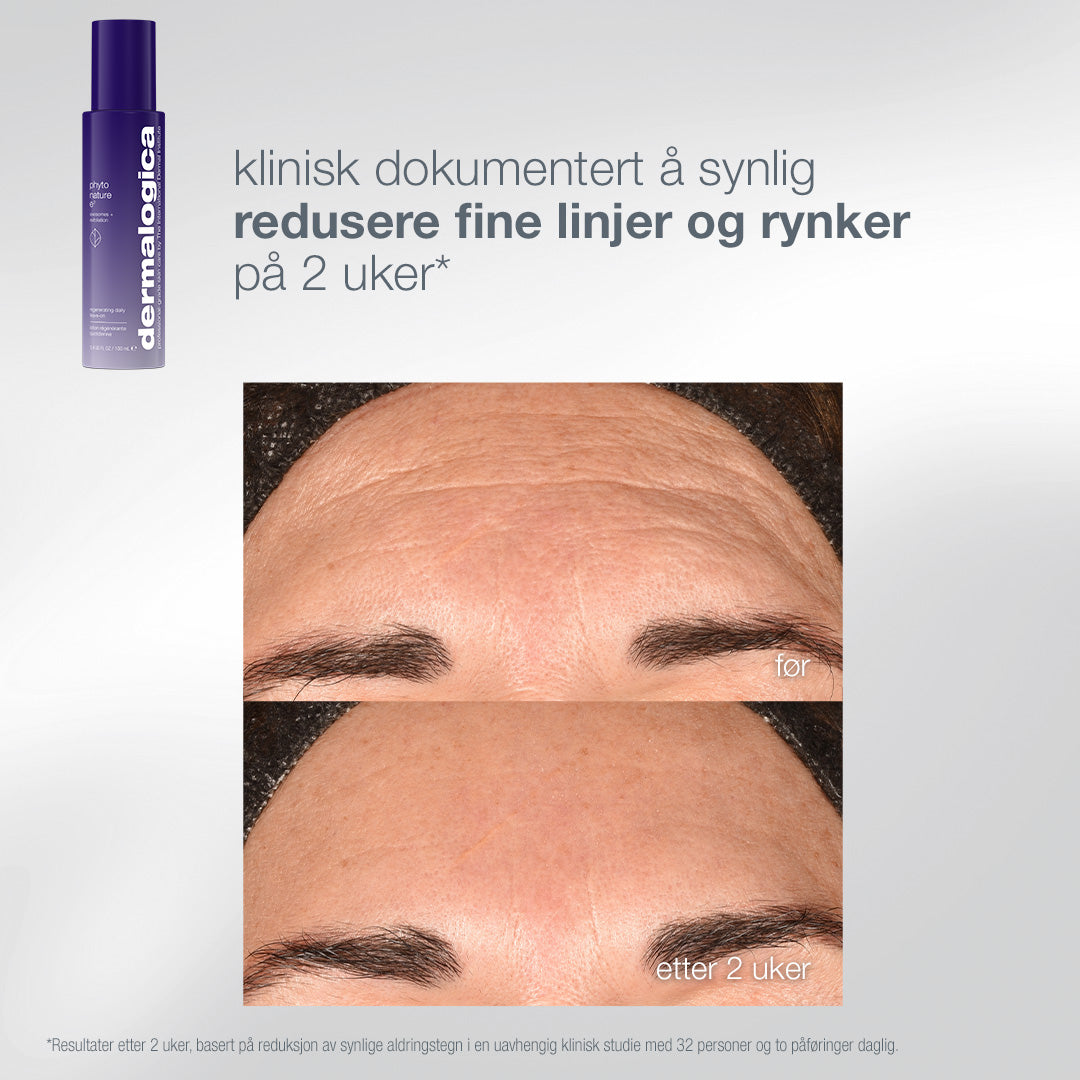 Phyto Nature E2 før og etter