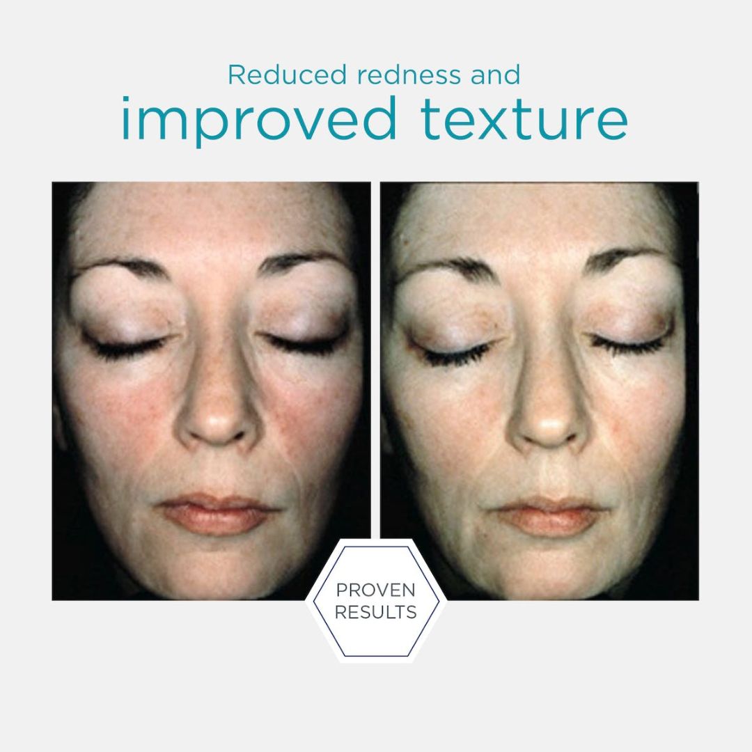Neostrata Restore Bionic Face Cream 40 g – rik nattkrem med PHA for tørr og sensitiv hud