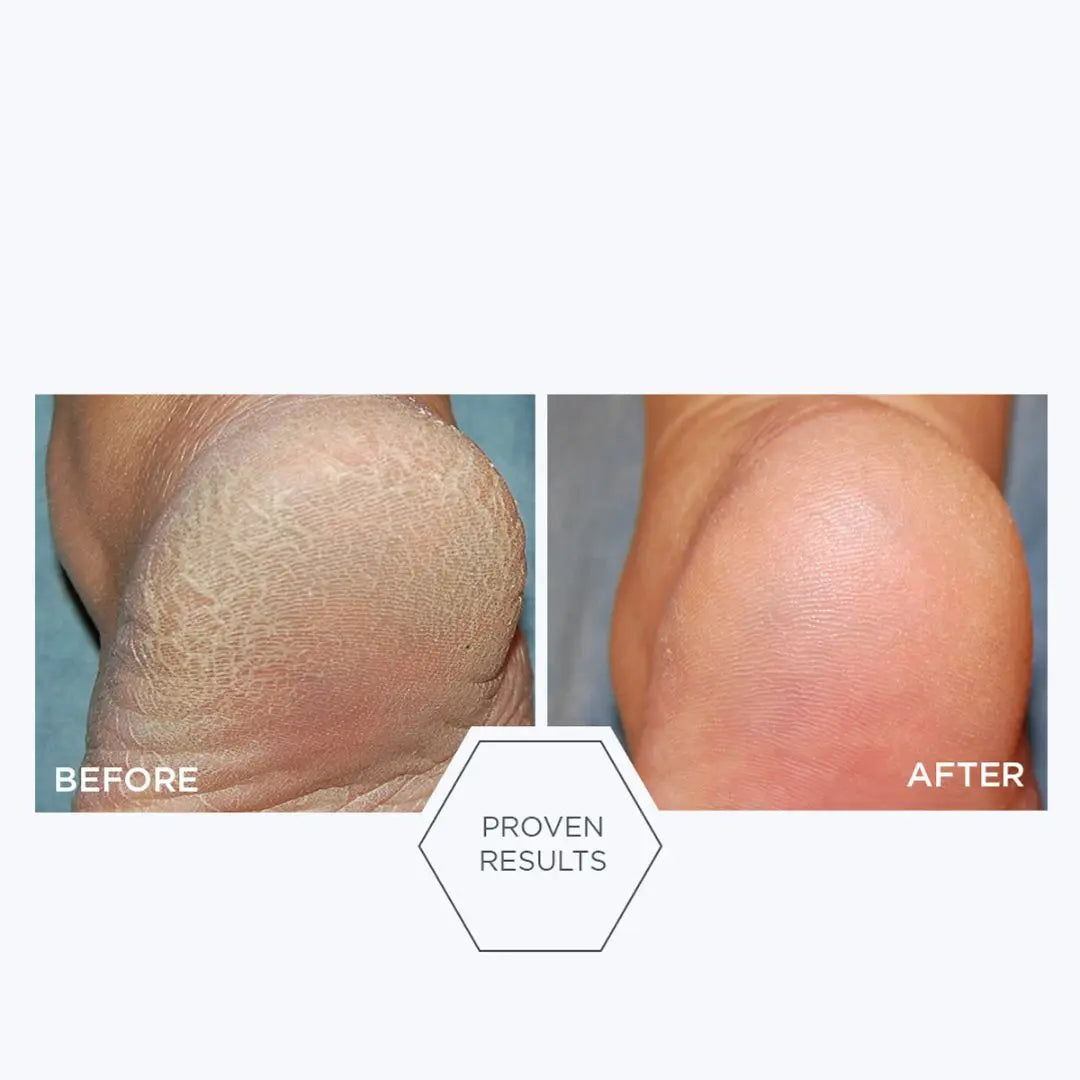Neostrata Resurface Problem Dry Skin 100 g
