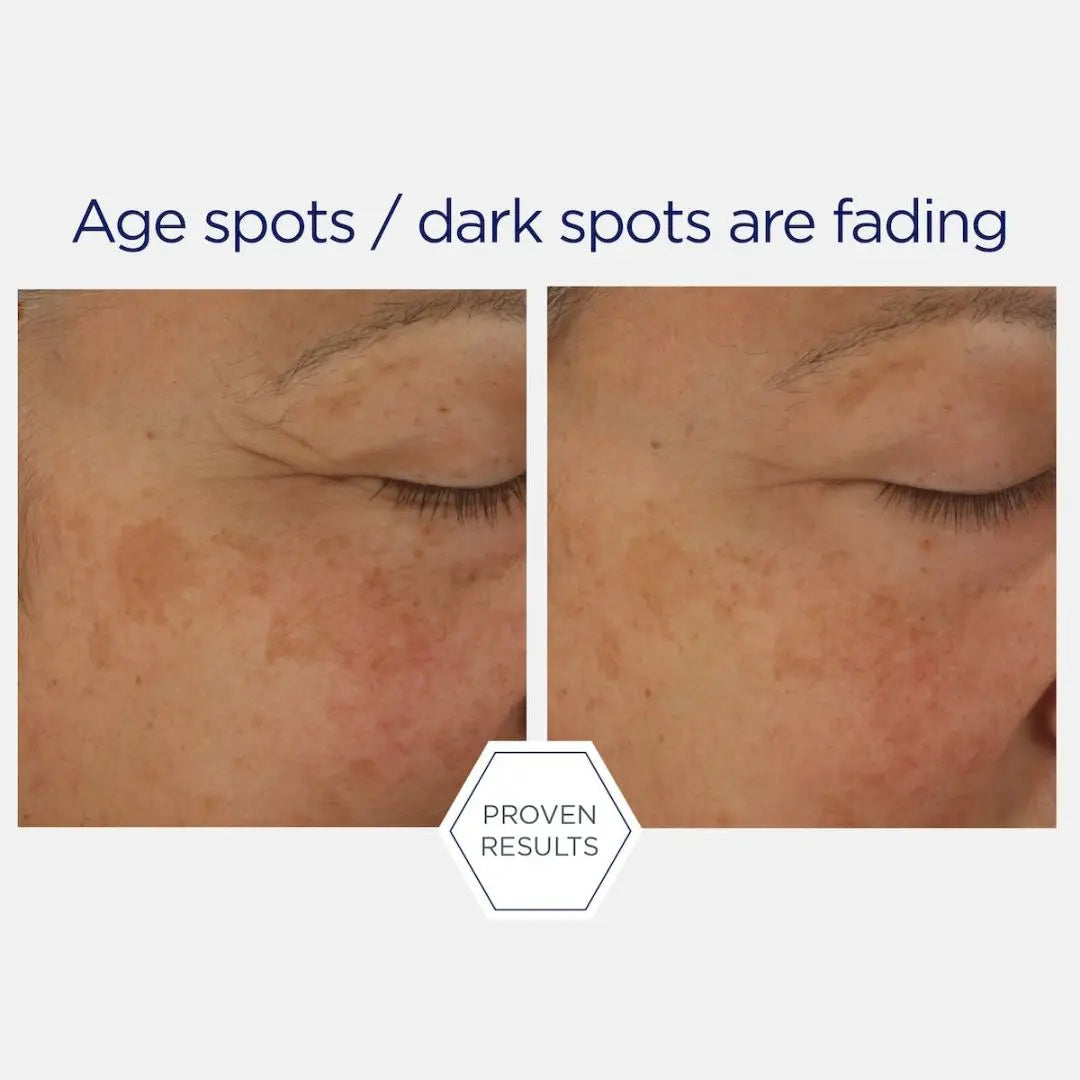 Neostrata Firming Potent Retinol Complex – mot rynker og ujevn hud 30 ml