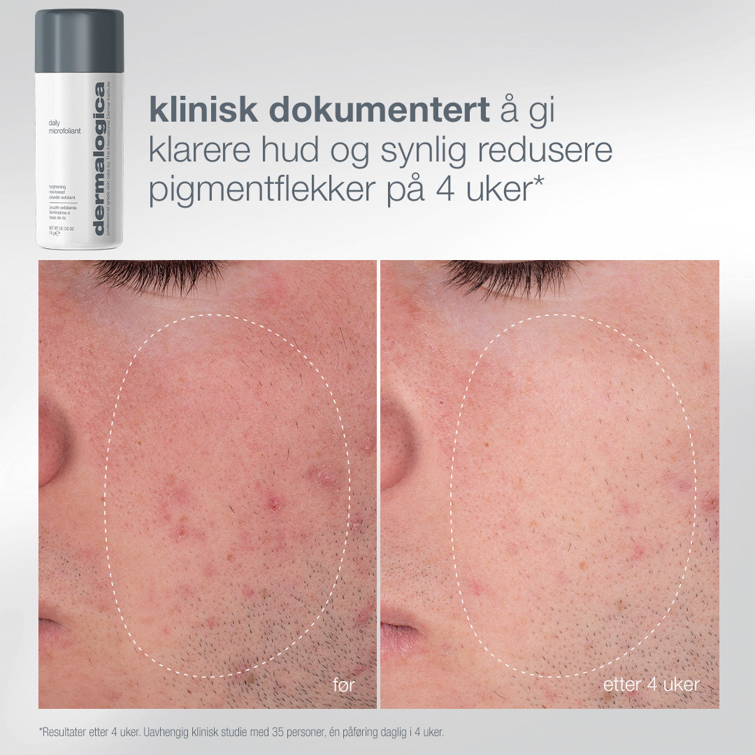 Daily Microfoliant før og etter