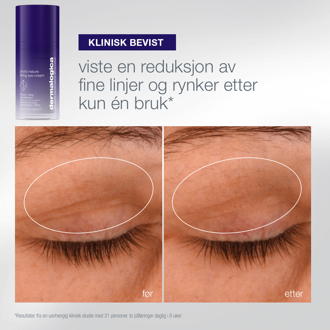 Lifting Eye Cream før og etter
