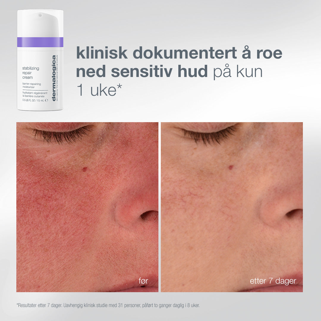 Stabilizing Repair Cream før og etter