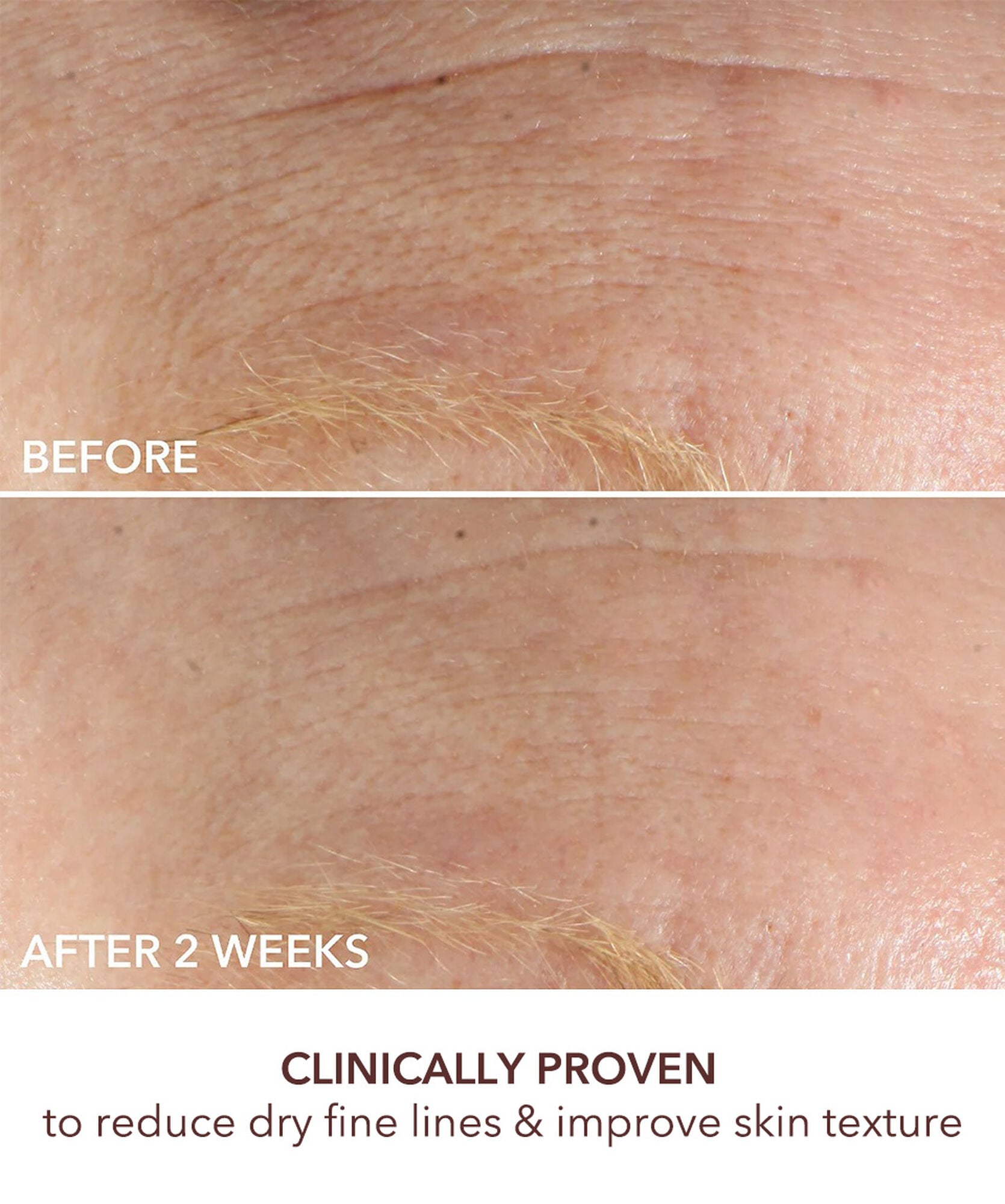 Dr Dennis Gross Advanced Retinol + Ferulic Wrinkle Repair Sett - www.Hudonline.no