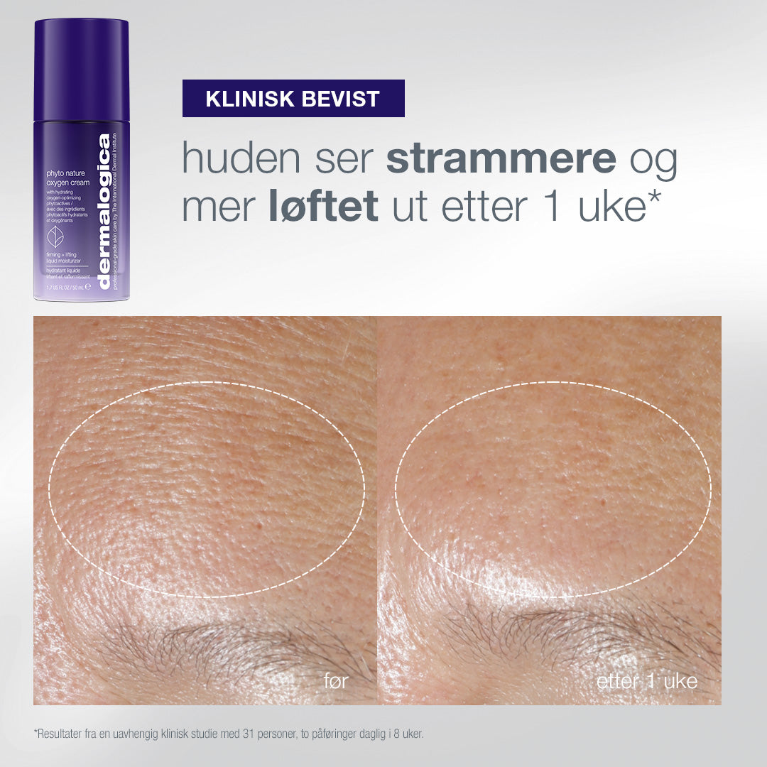 Oxygen Cream før og etter