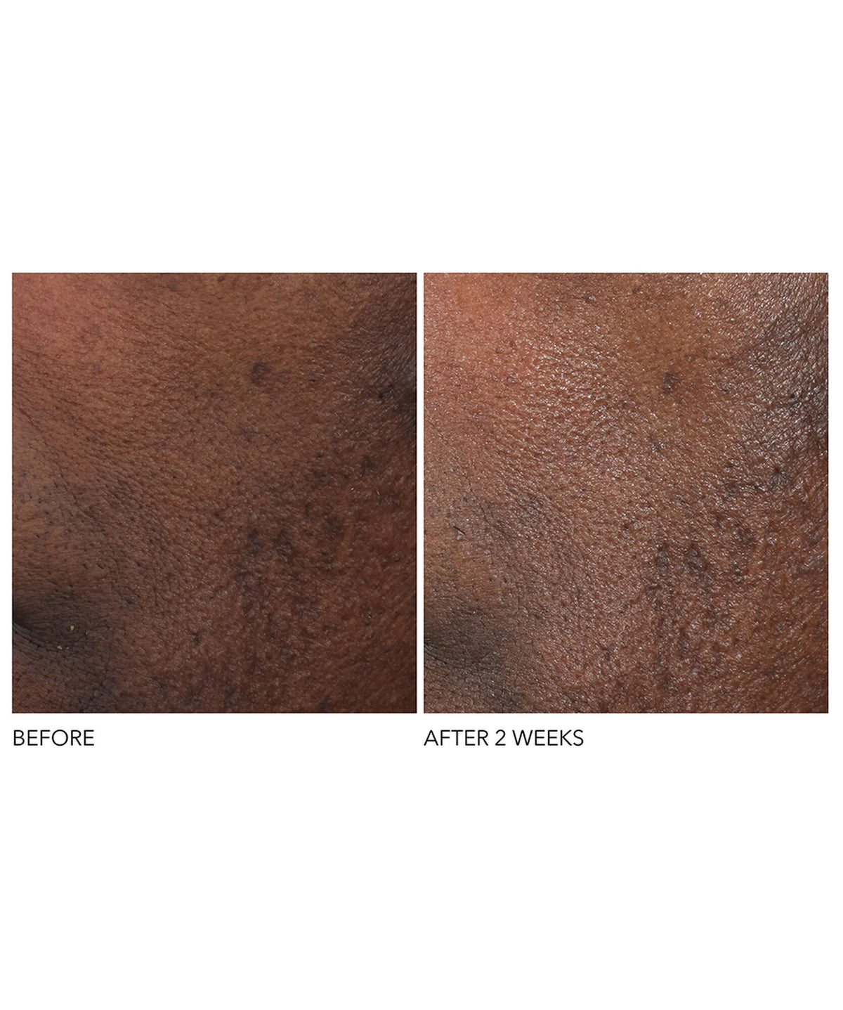 Dr Dennis Gross Advanced Retinol+Ferulic Overnight Wrinkle Treatment - www.Hudonline.no