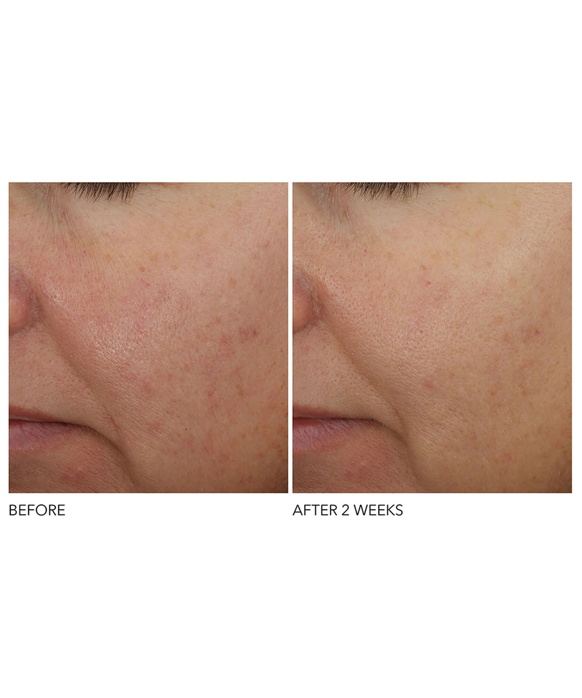 Dr Dennis Gross Advanced Retinol+Ferulic Overnight Wrinkle Treatment - www.Hudonline.no