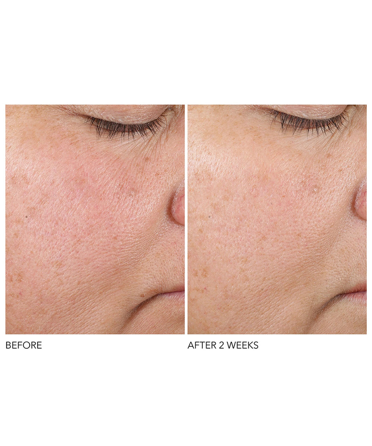 Dr Dennis Gross Advanced Retinol+Ferulic Texture Renewal Serum - www.Hudonline.no