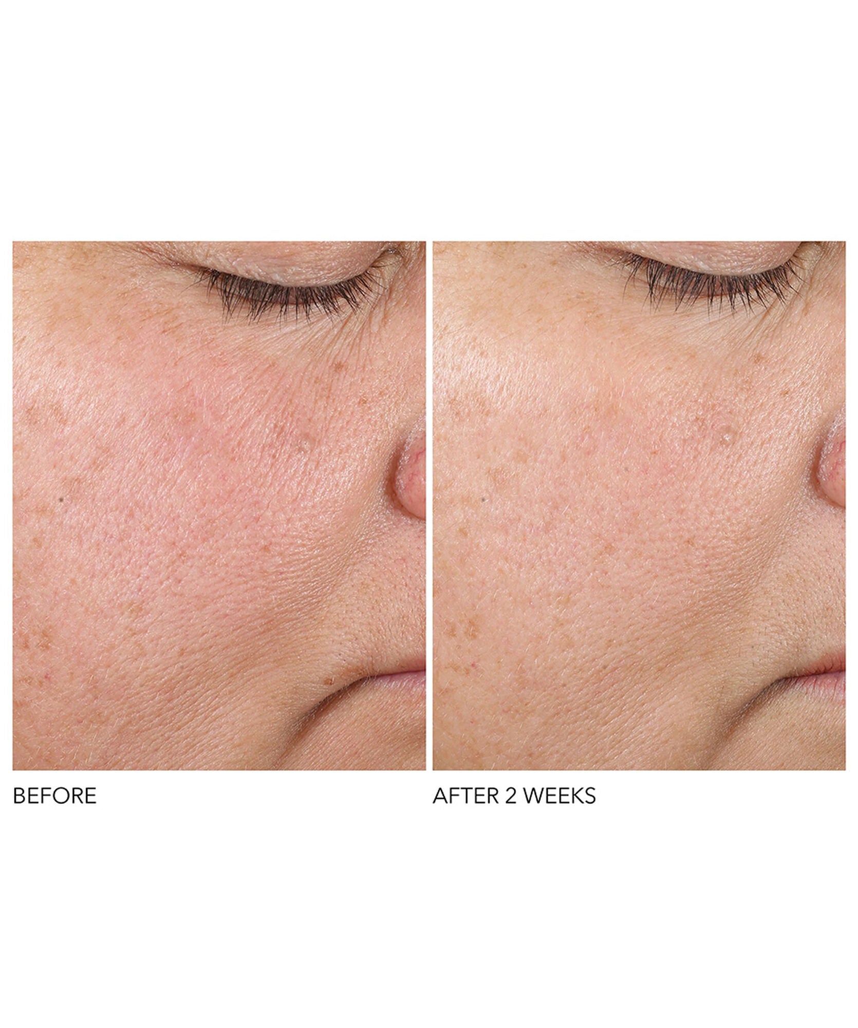Dr Dennis Gross Advanced Retinol+Ferulic Texture Renewal Serum - www.Hudonline.no