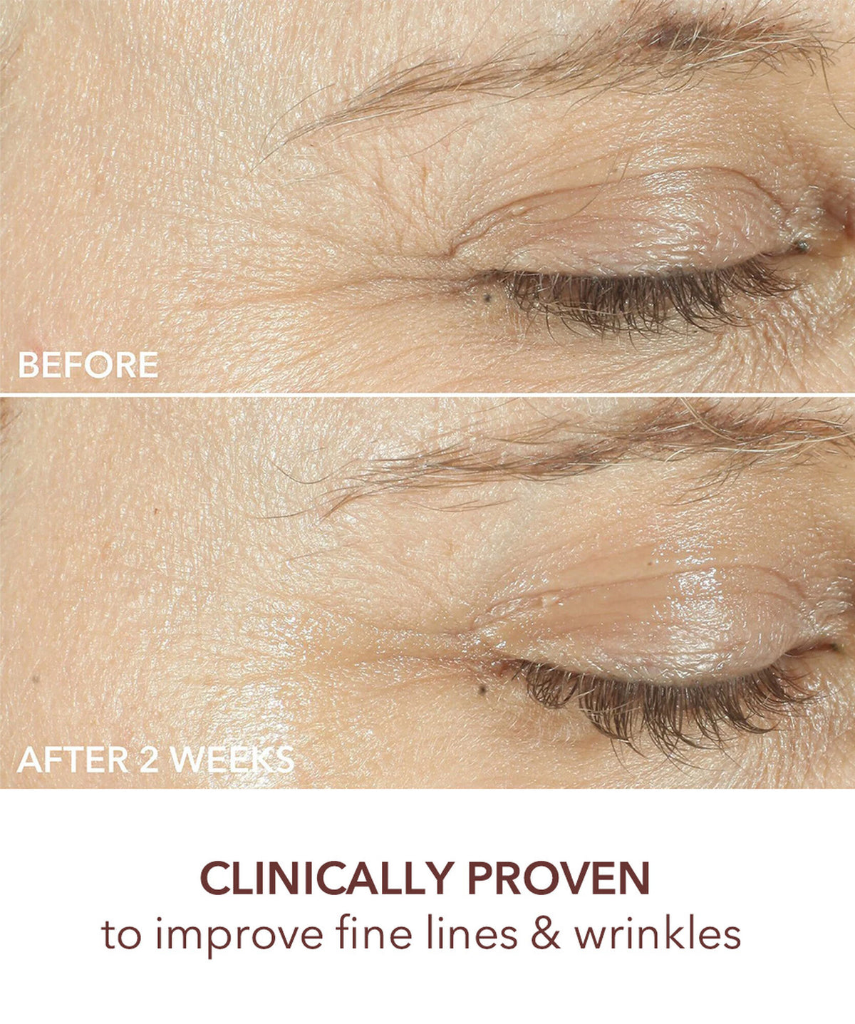 Dr Dennis Gross Advanced Retinol+Ferulic Triple Correction Eye Serum - www.Hudonline.no