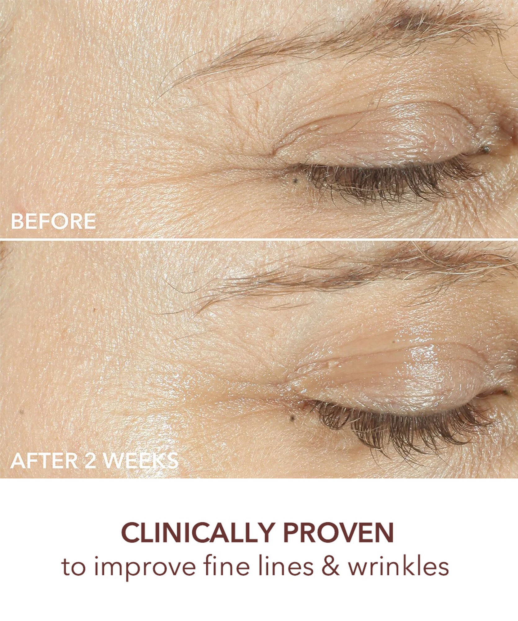 Dr Dennis Gross Advanced Retinol+Ferulic Triple Correction Eye Serum - www.Hudonline.no