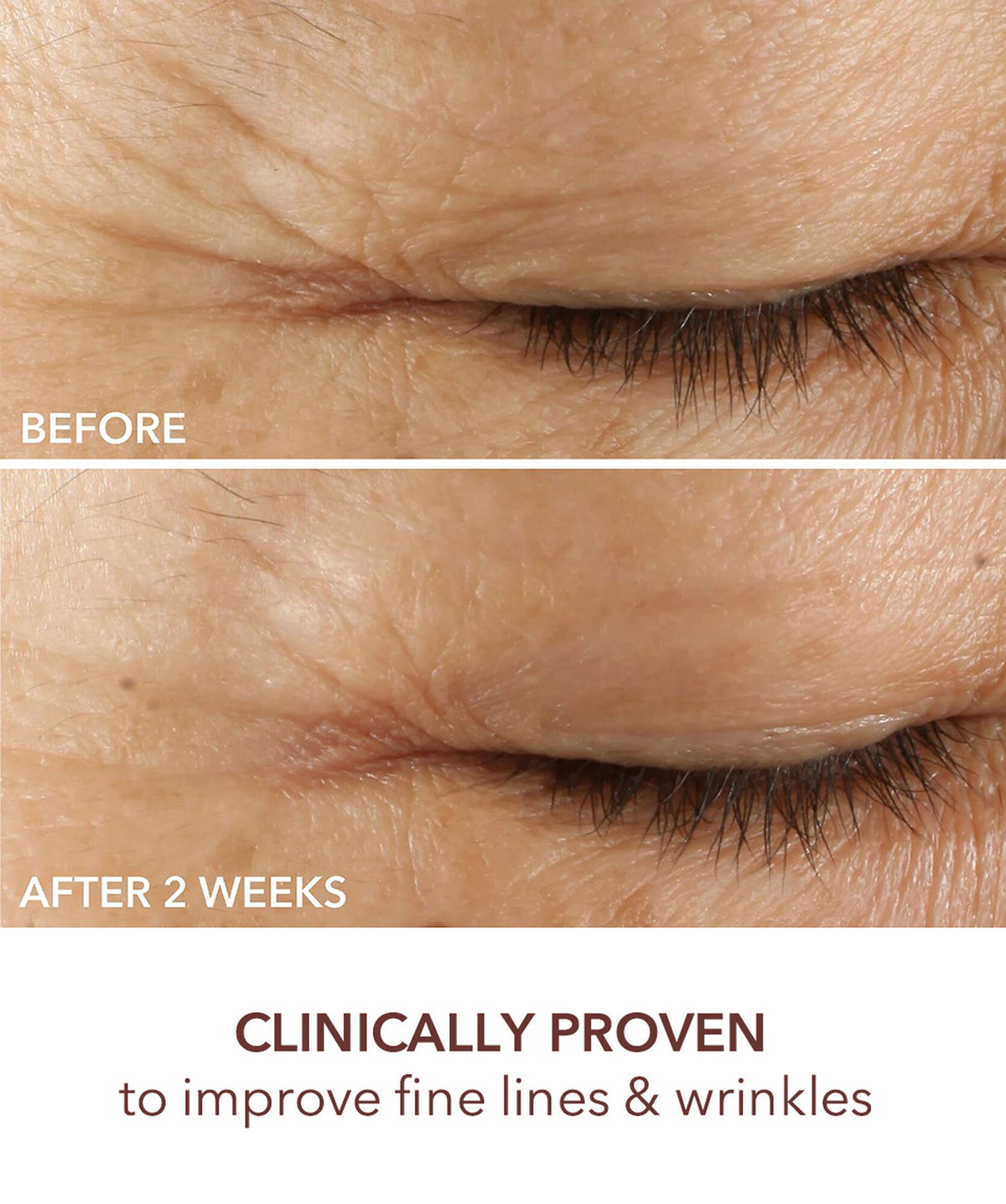 Dr Dennis Gross Advanced Retinol+Ferulic Triple Correction Eye Serum - www.Hudonline.no