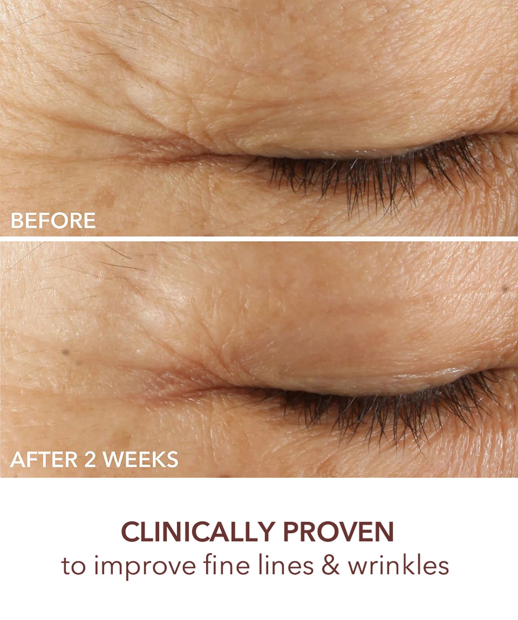 Dr Dennis Gross Advanced Retinol+Ferulic Triple Correction Eye Serum - www.Hudonline.no