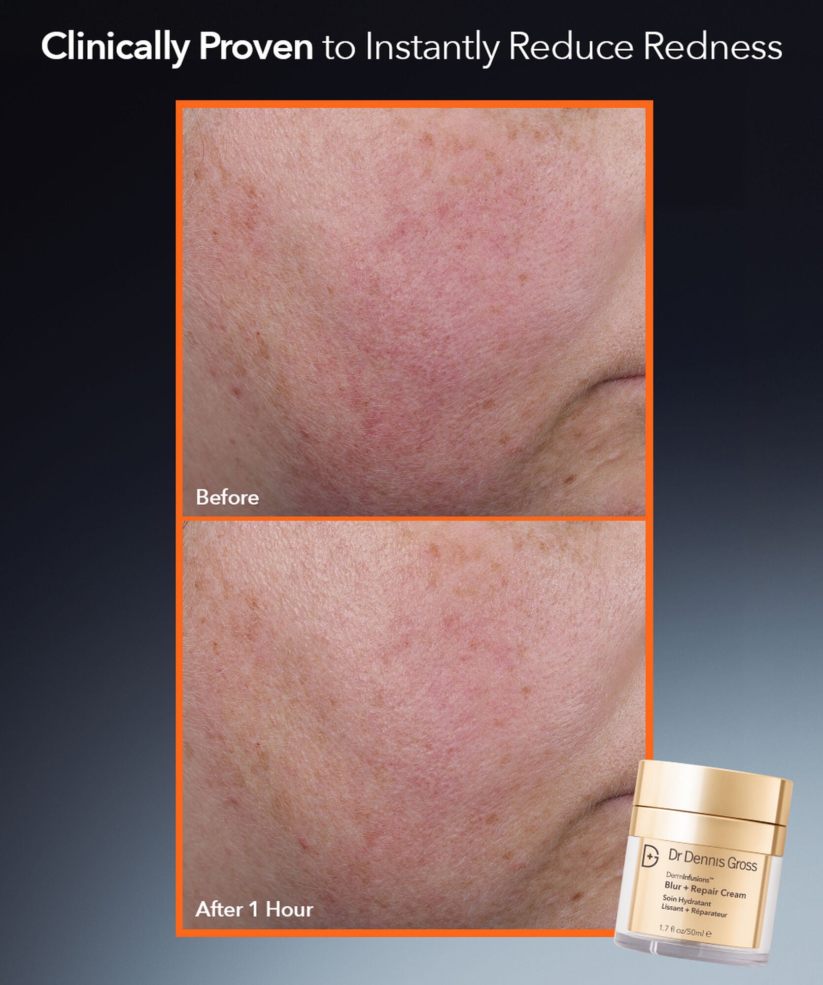 Dr Dennis Gross Blur+Repair Cream 20 ml - www.Hudonline.no