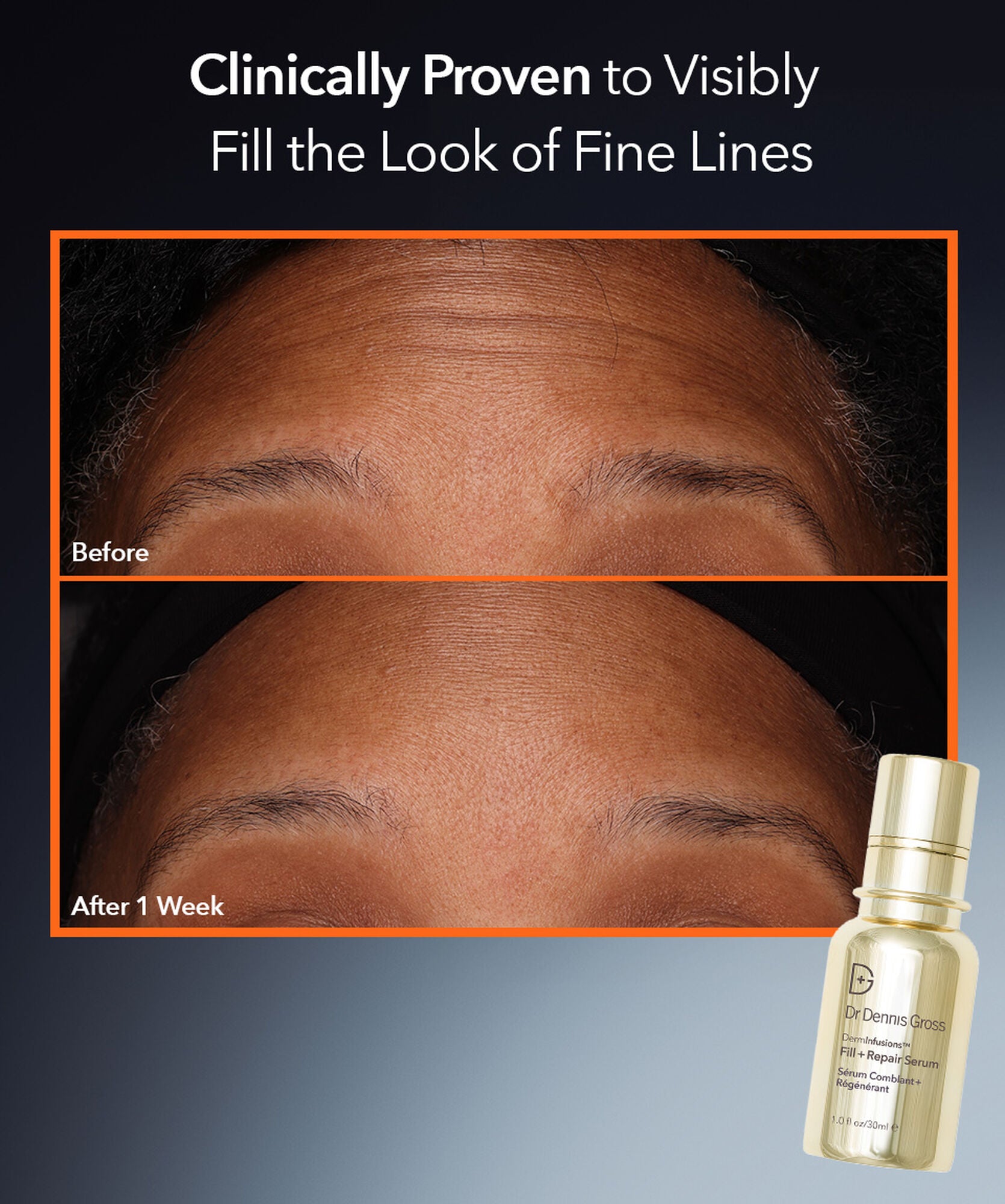 Dr Dennis Gross DermInfusions Fill + Repair Serum - www.Hudonline.no