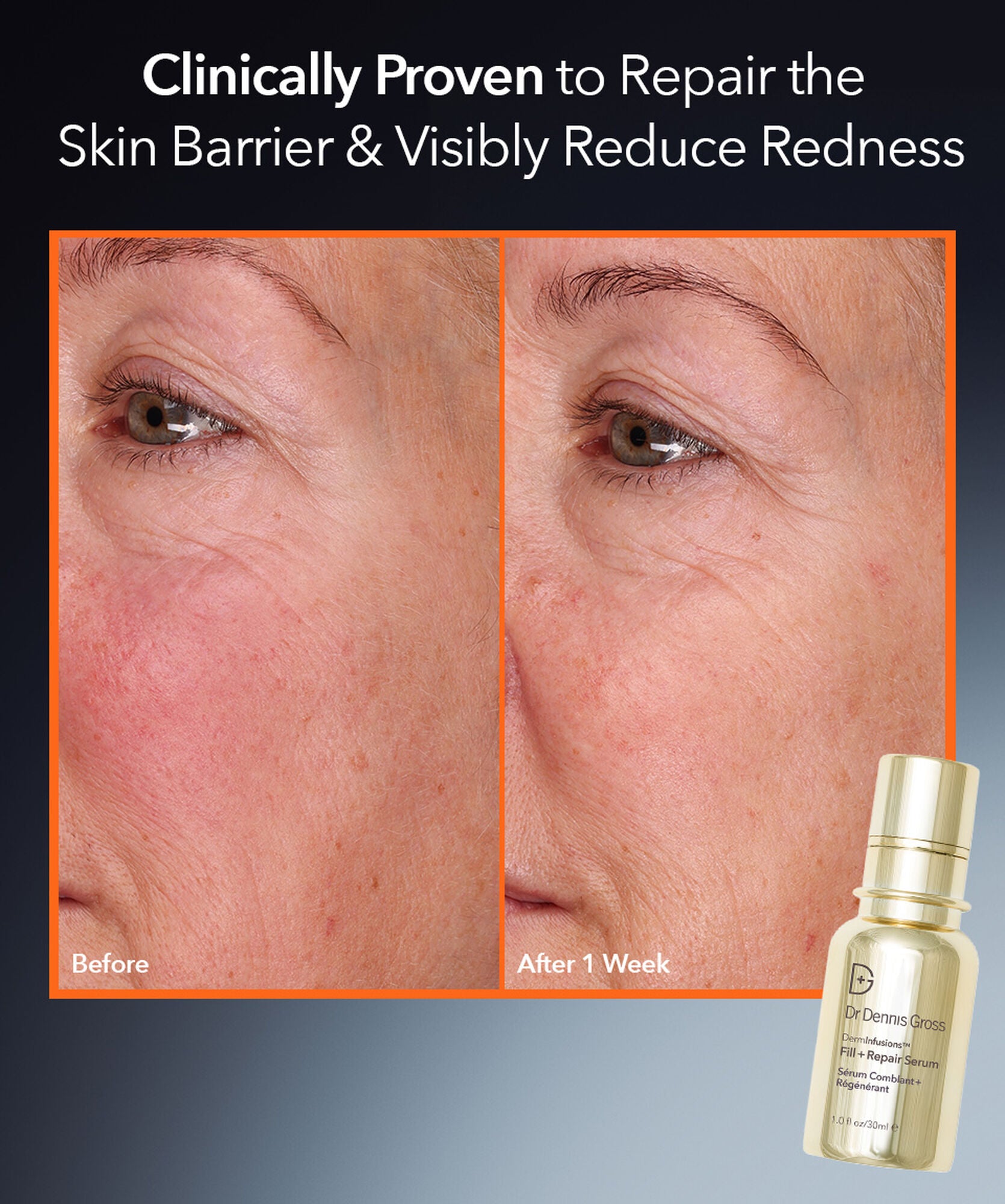 Dr Dennis Gross DermInfusions Fill + Repair Serum - www.Hudonline.no