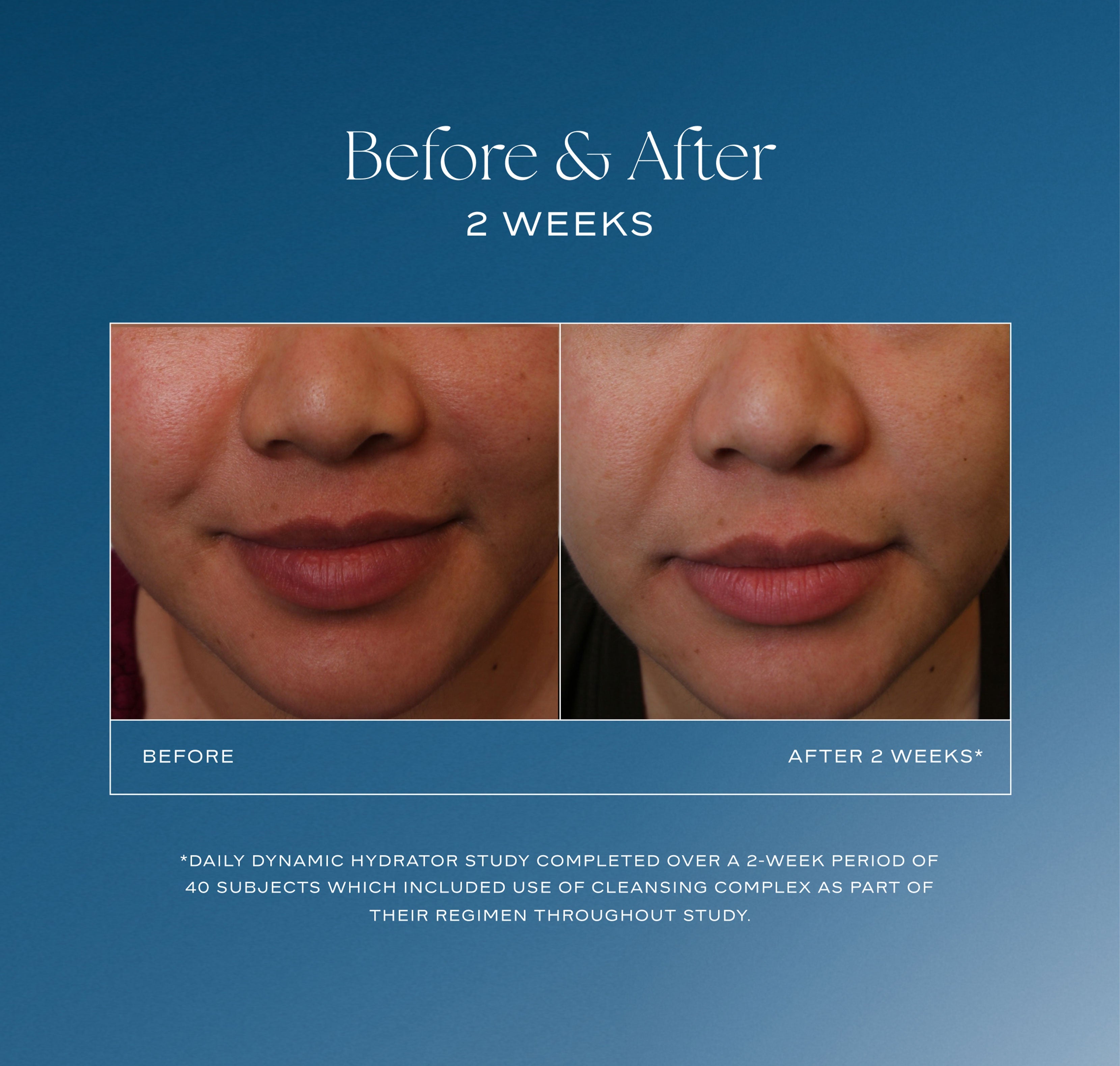 iS Clinical Daily Dynamic Hydrator 50 g