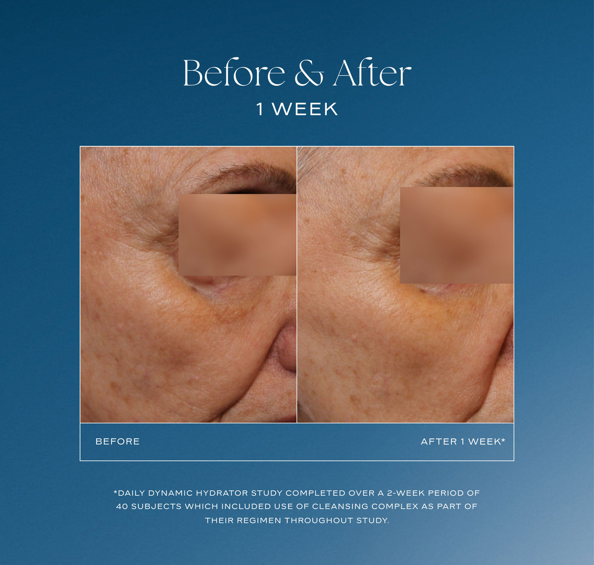iS Clinical Daily Dynamic Hydrator 50 g