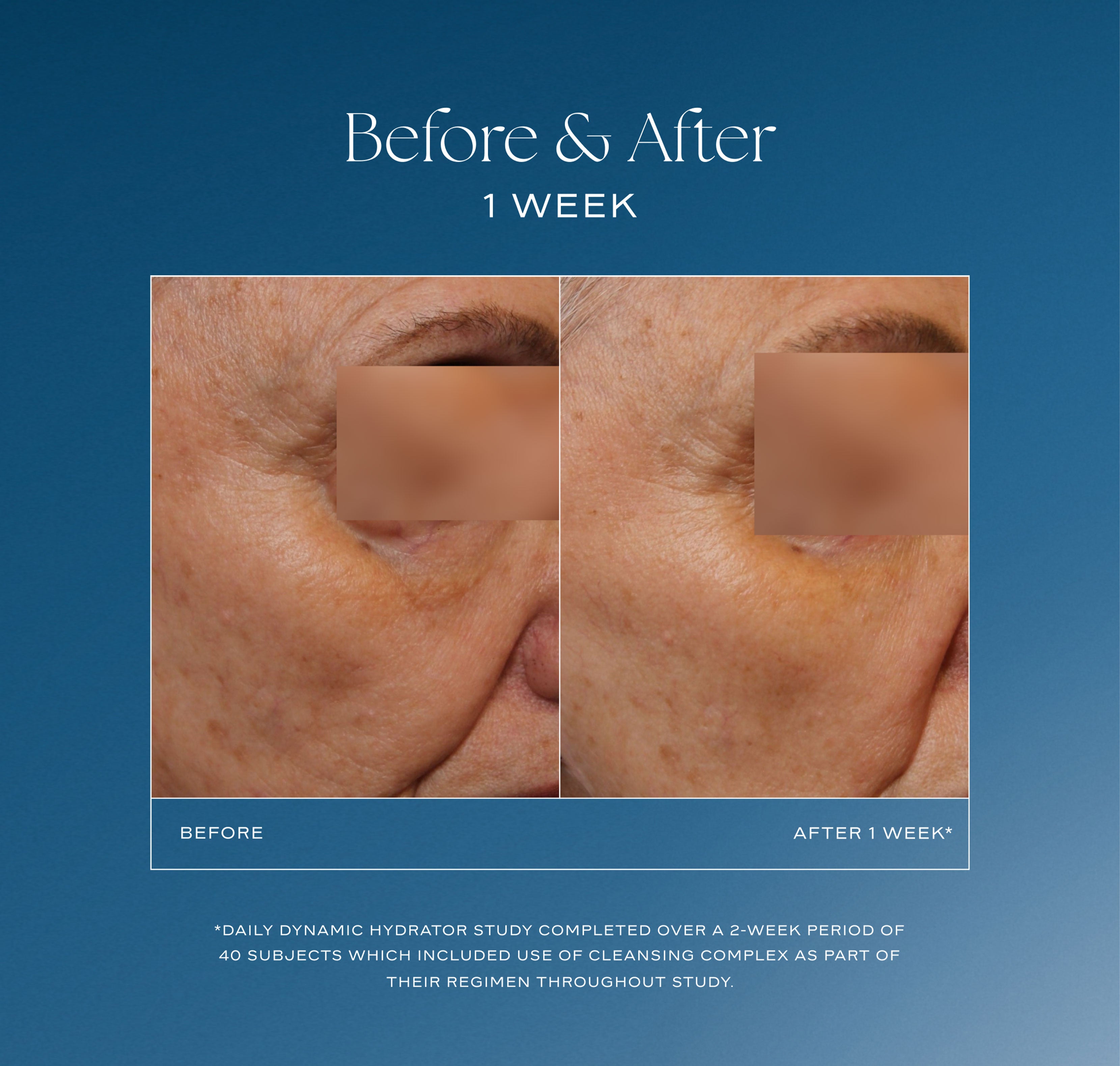 iS Clinical Daily Dynamic Hydrator 50 g