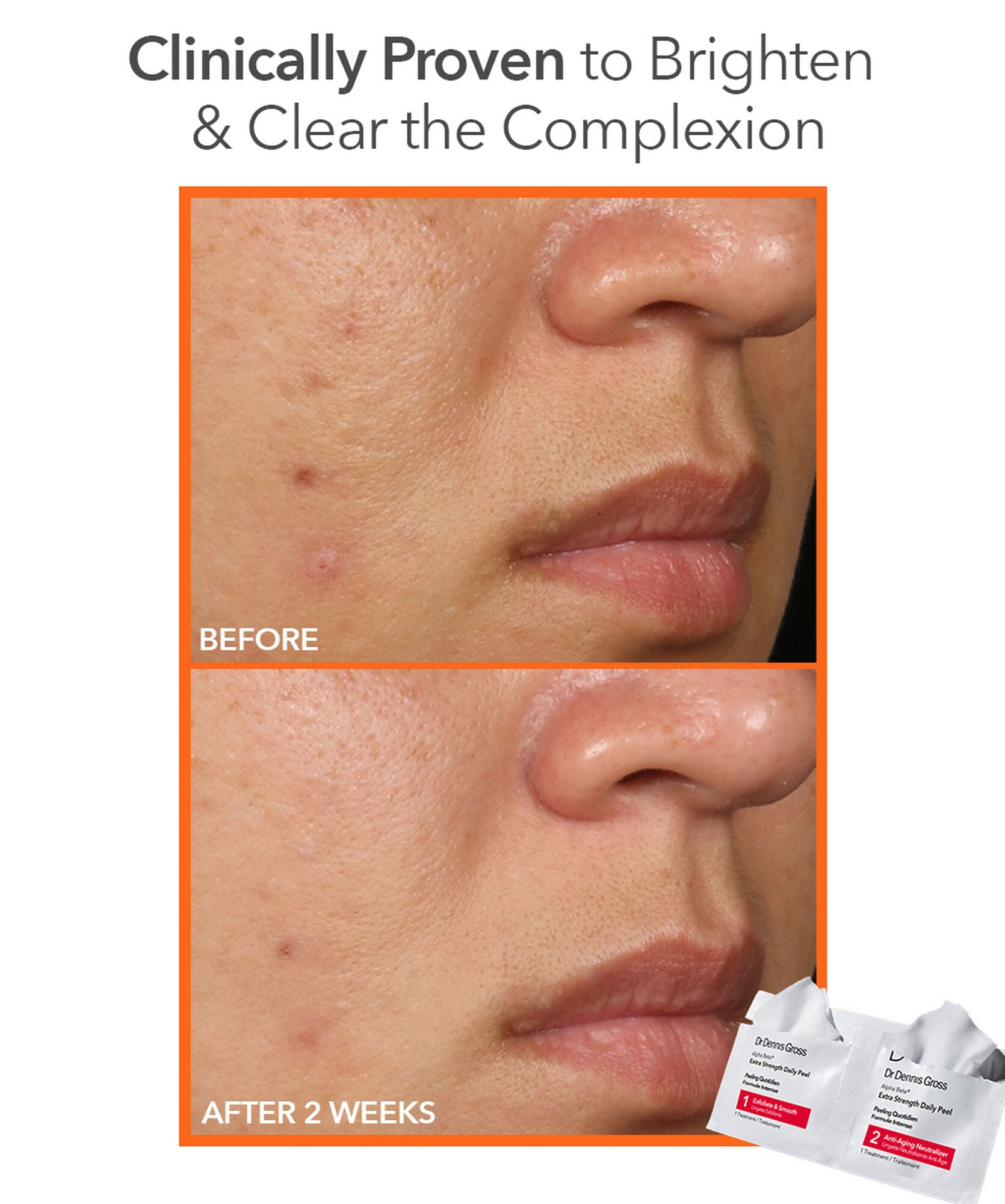 Dr Dennis Gross Alpha Beta Peel Extra Strength 30pk - www.Hudonline.no