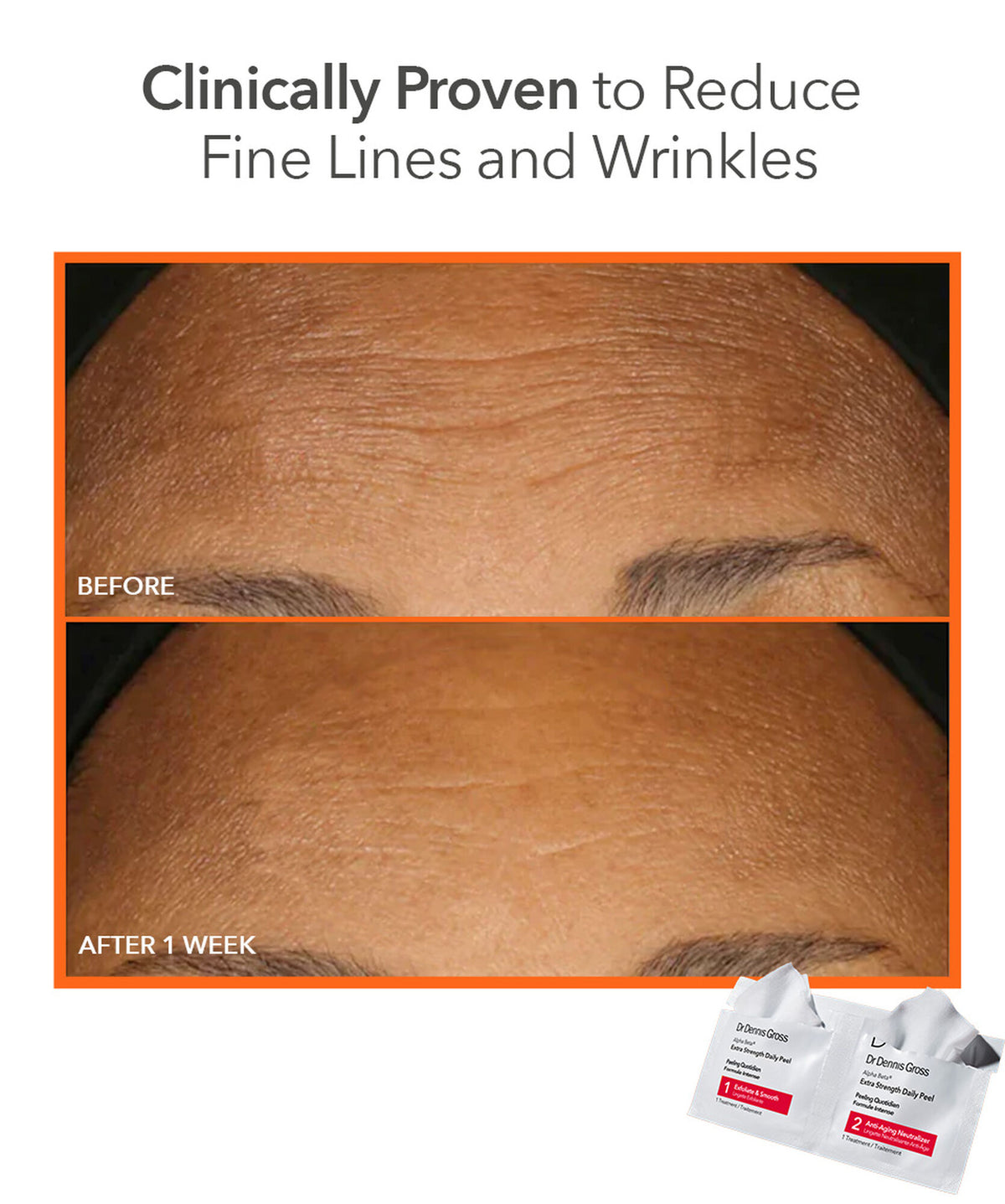 Dr Dennis Gross Face Peel Extra Strength - www.Hudonline.no