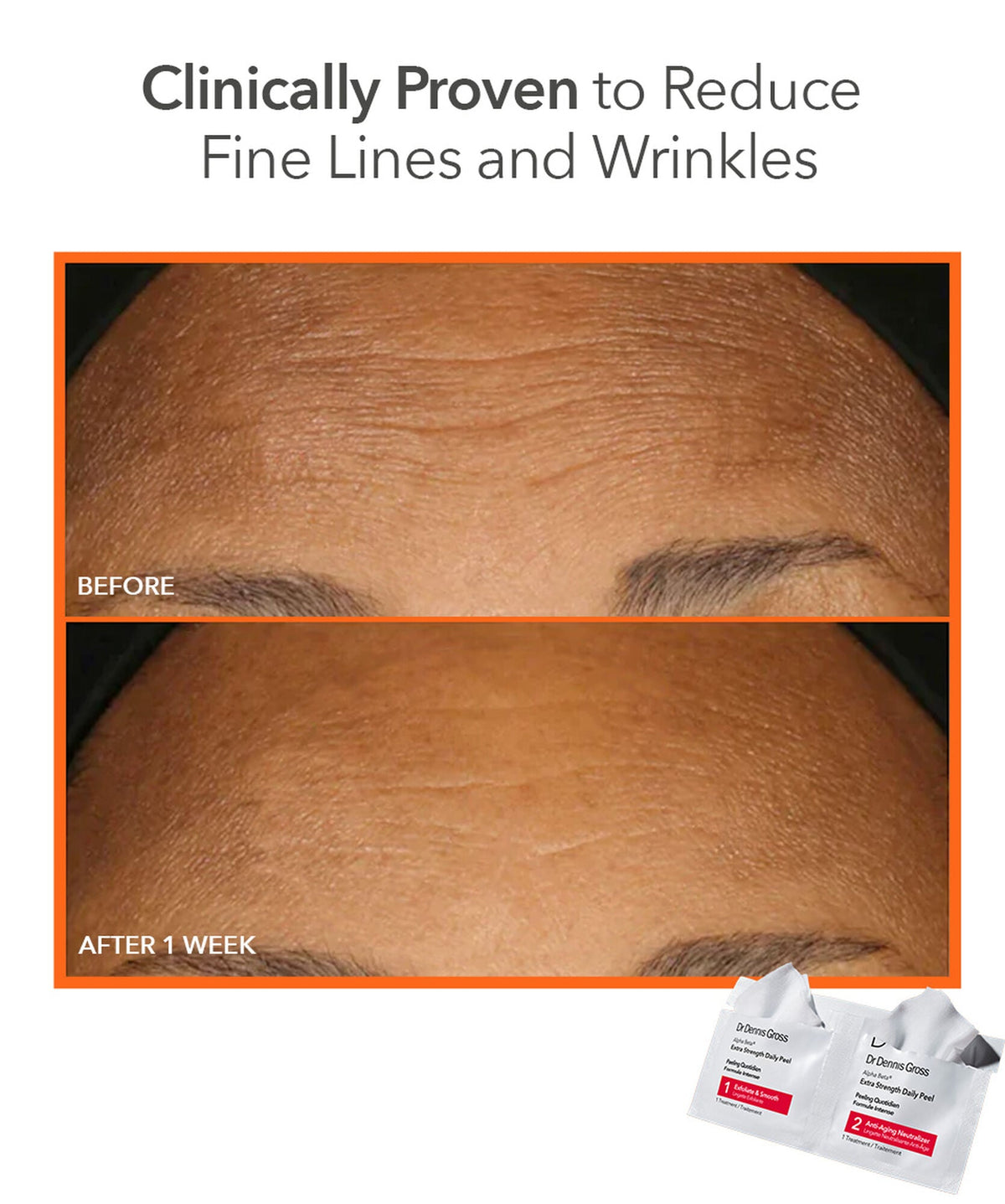 Dr Dennis Gross Alpha Beta Peel Extra Strength 30pk - www.Hudonline.no