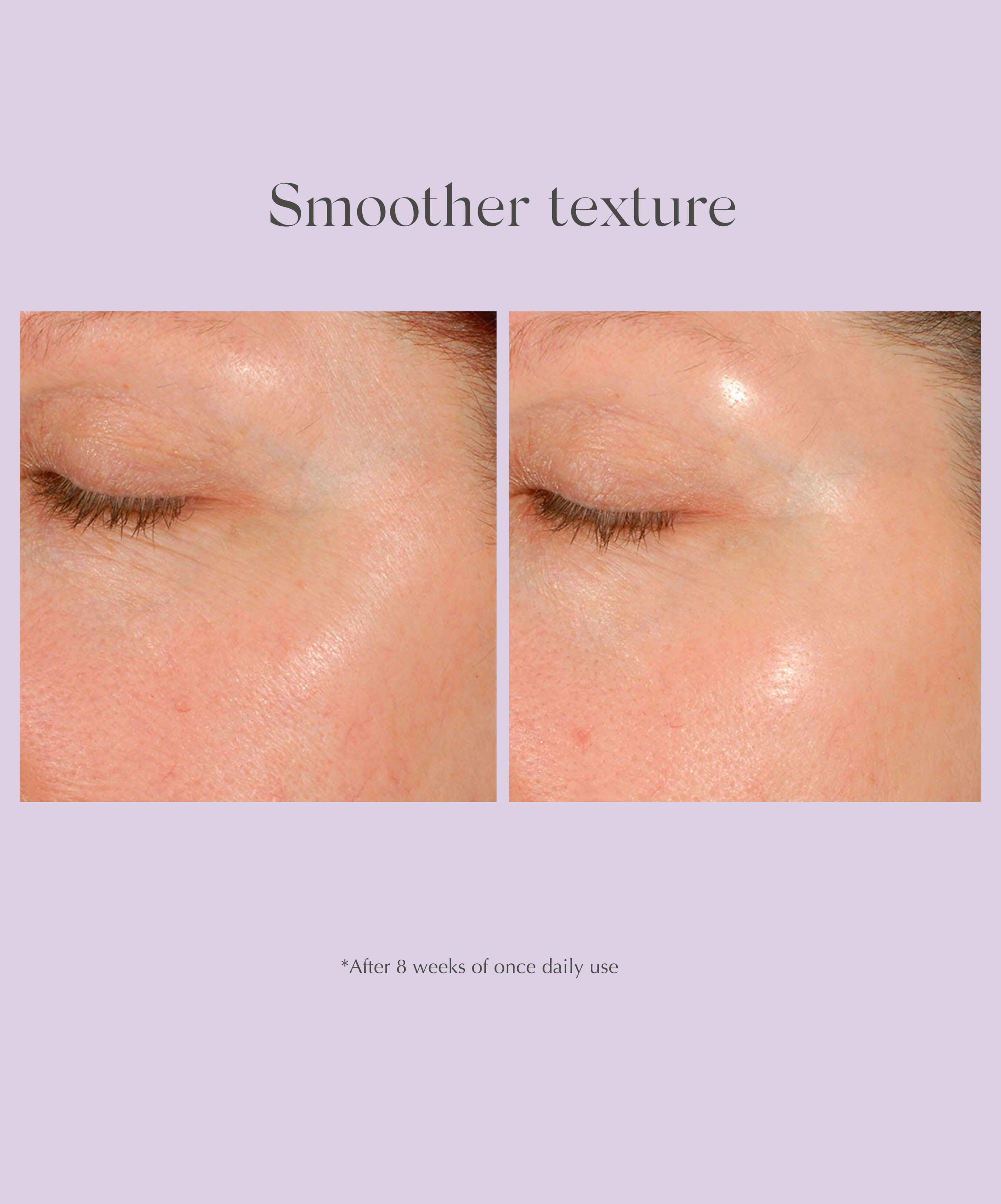 Exuviance Daily Resurfacing Peel CA10 bruk