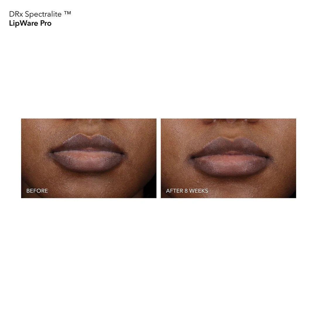 Dr Dennis Gross DRx SpectraLite LipWare Pro - www.Hudonline.no 