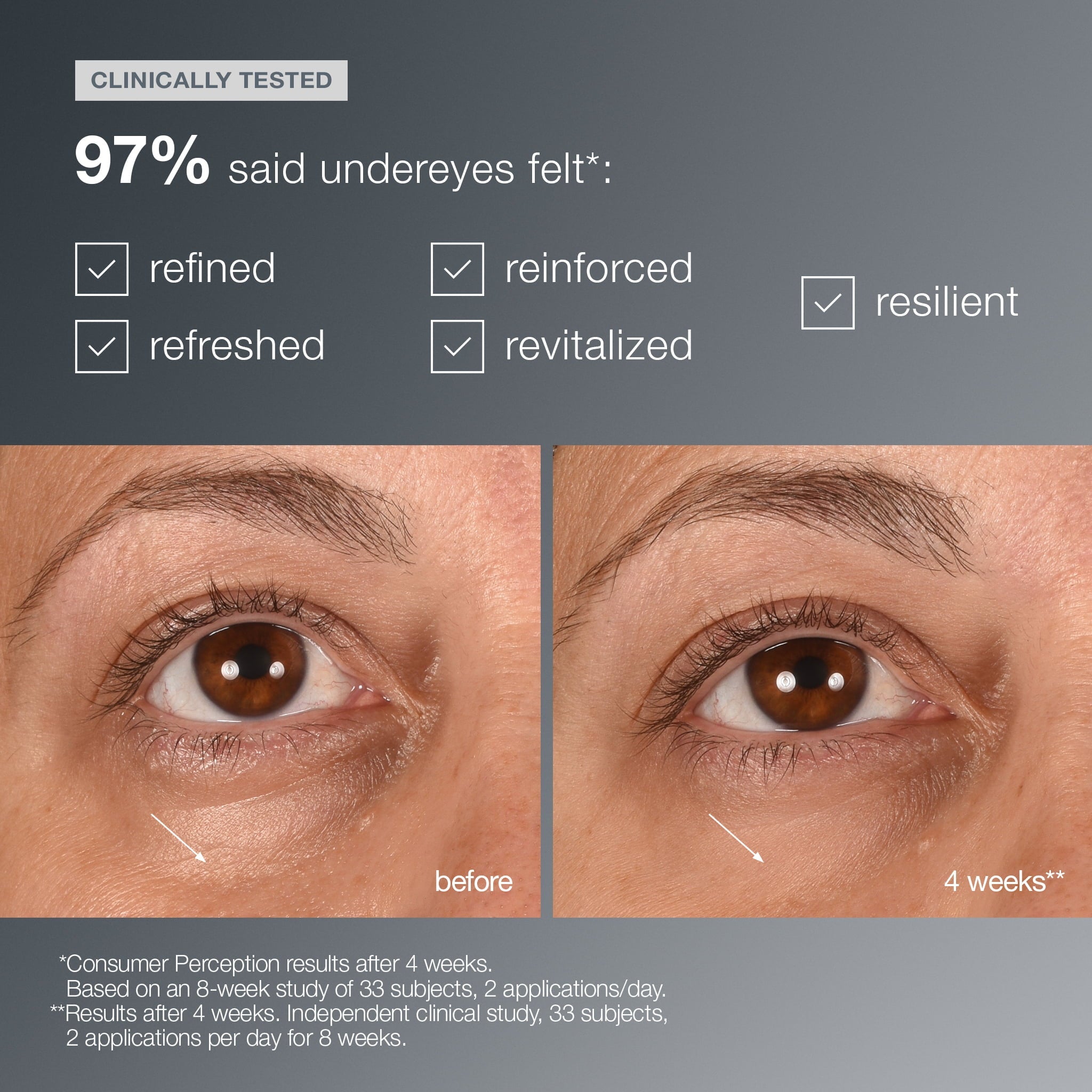 Smart Eye Density – klinisk før/etter 2