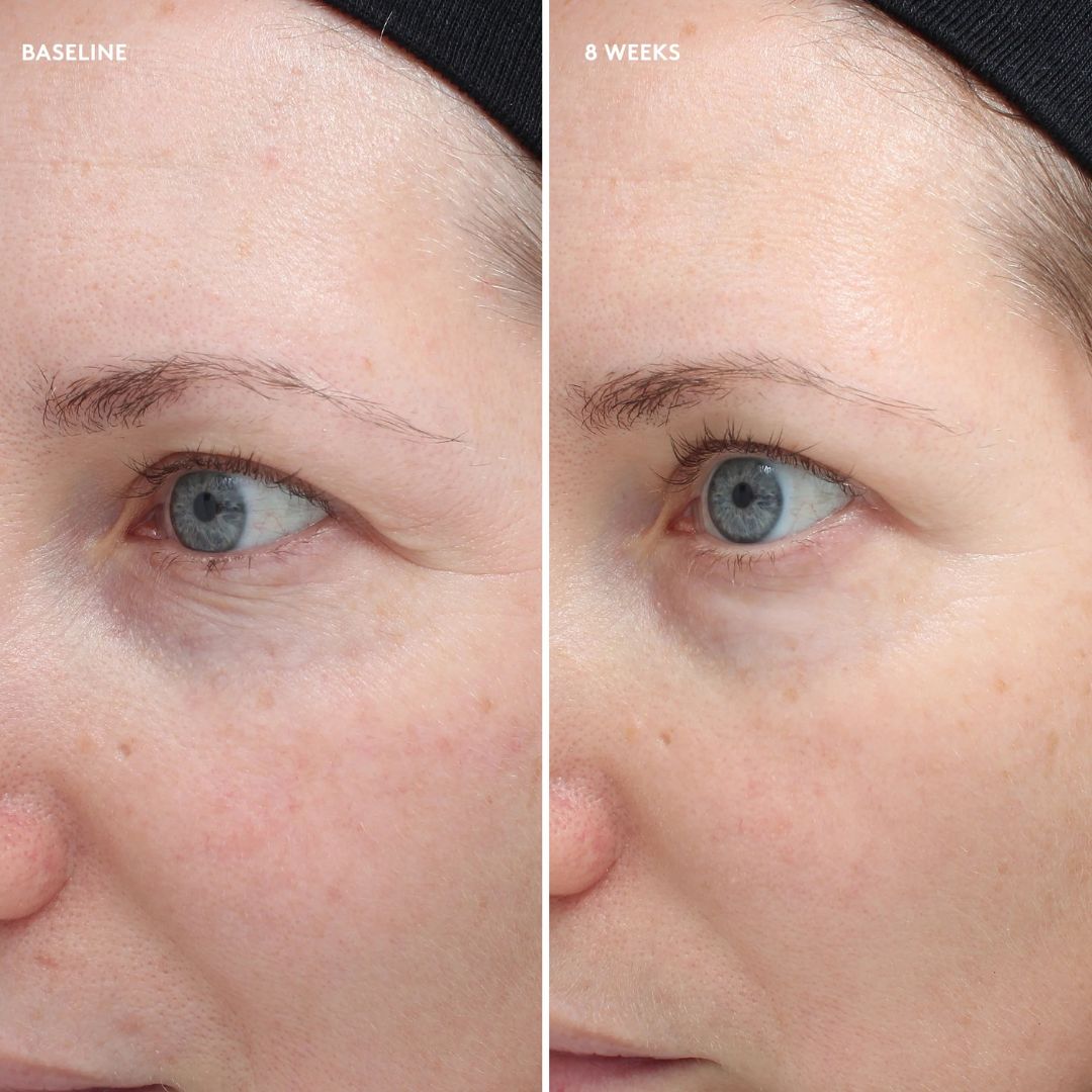 Colorescience Total Eye Firm & Repair Cream - www.Hudonline.no 