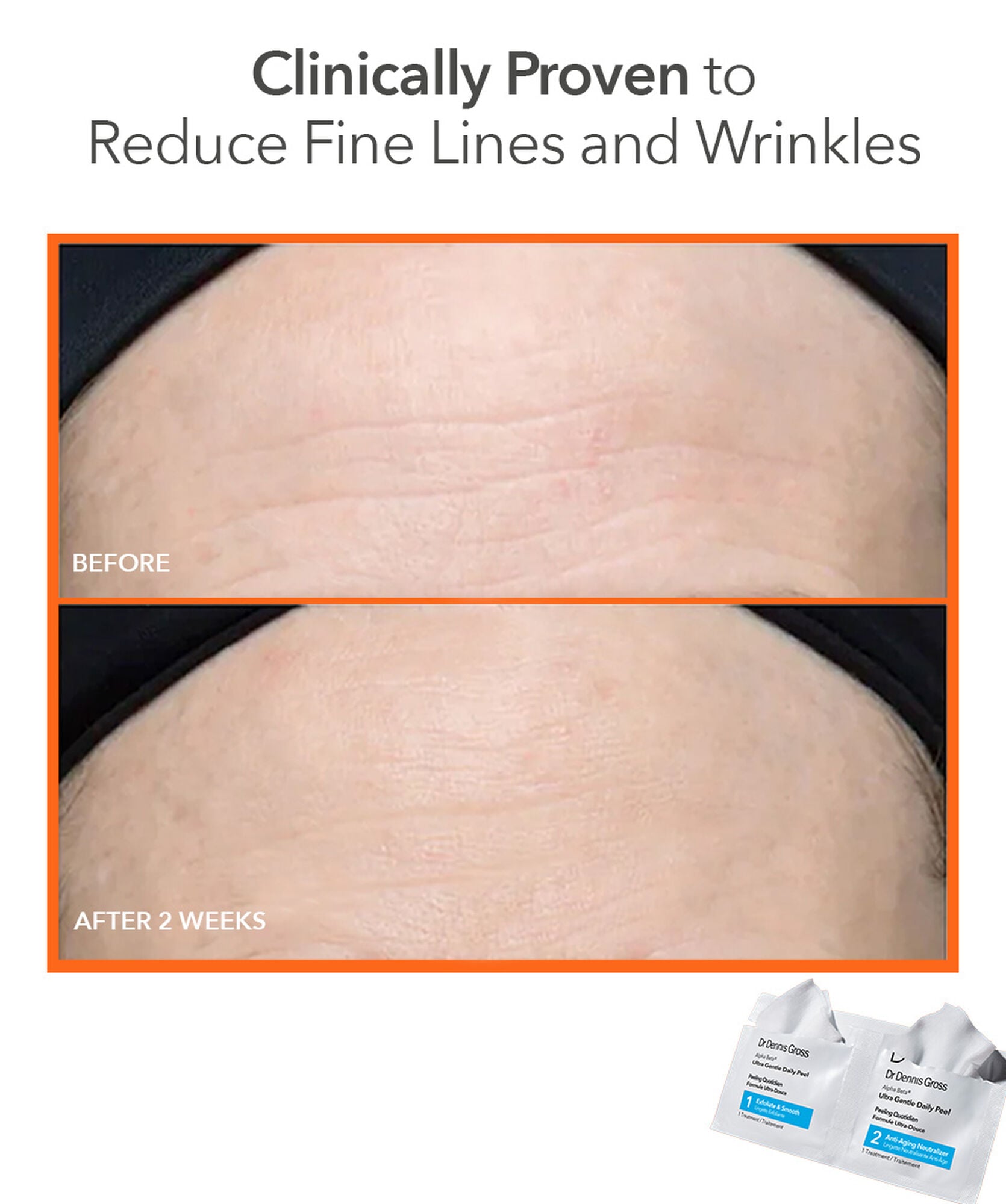 Dr Dennis Gross Alpha Beta Face Peel Ultra Gentle PeelPads - www.Hudonline.no