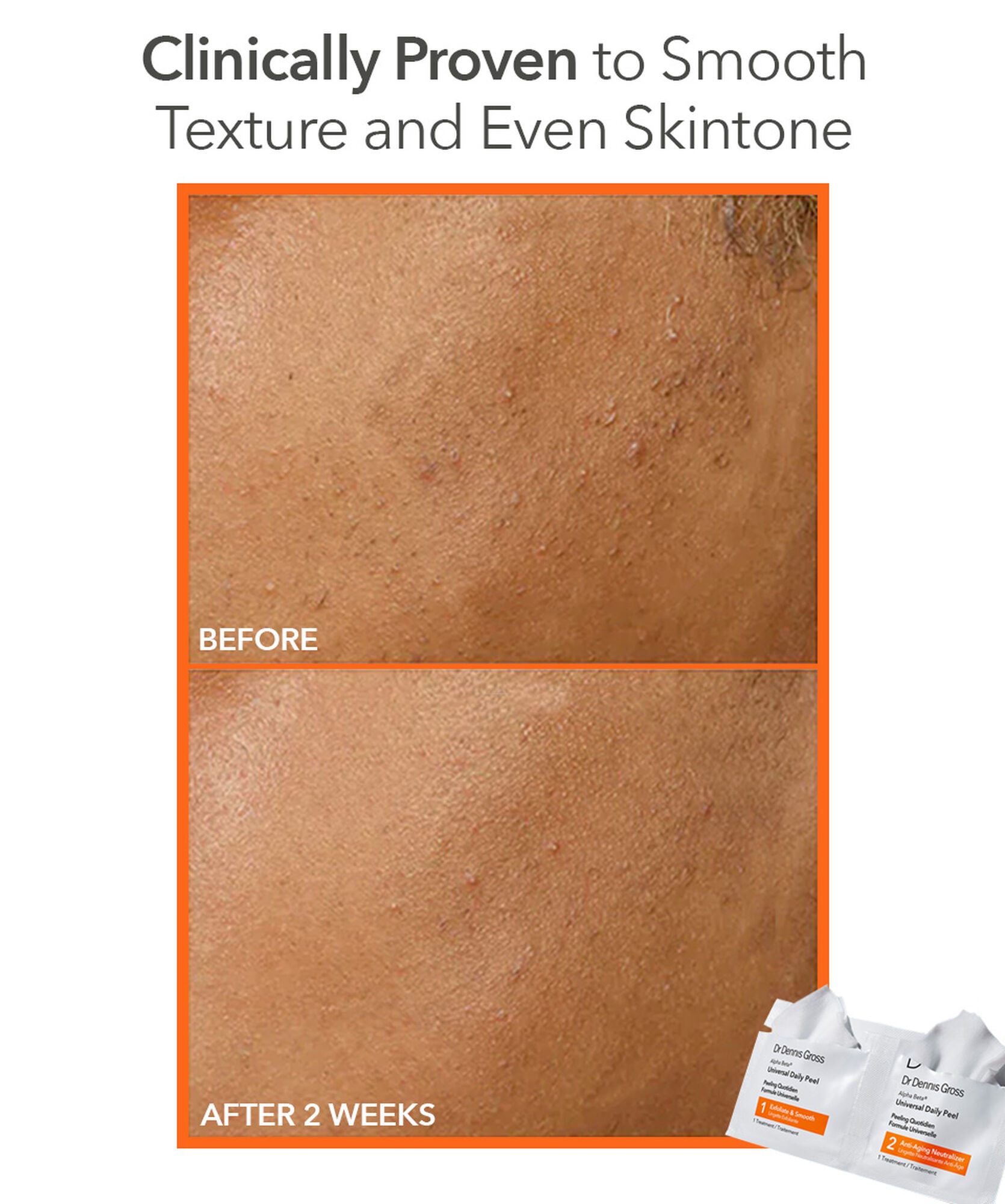 Dr Dennis Gross Alpha Beta Universal Daily Peel 30pk - www.Hudonline.no