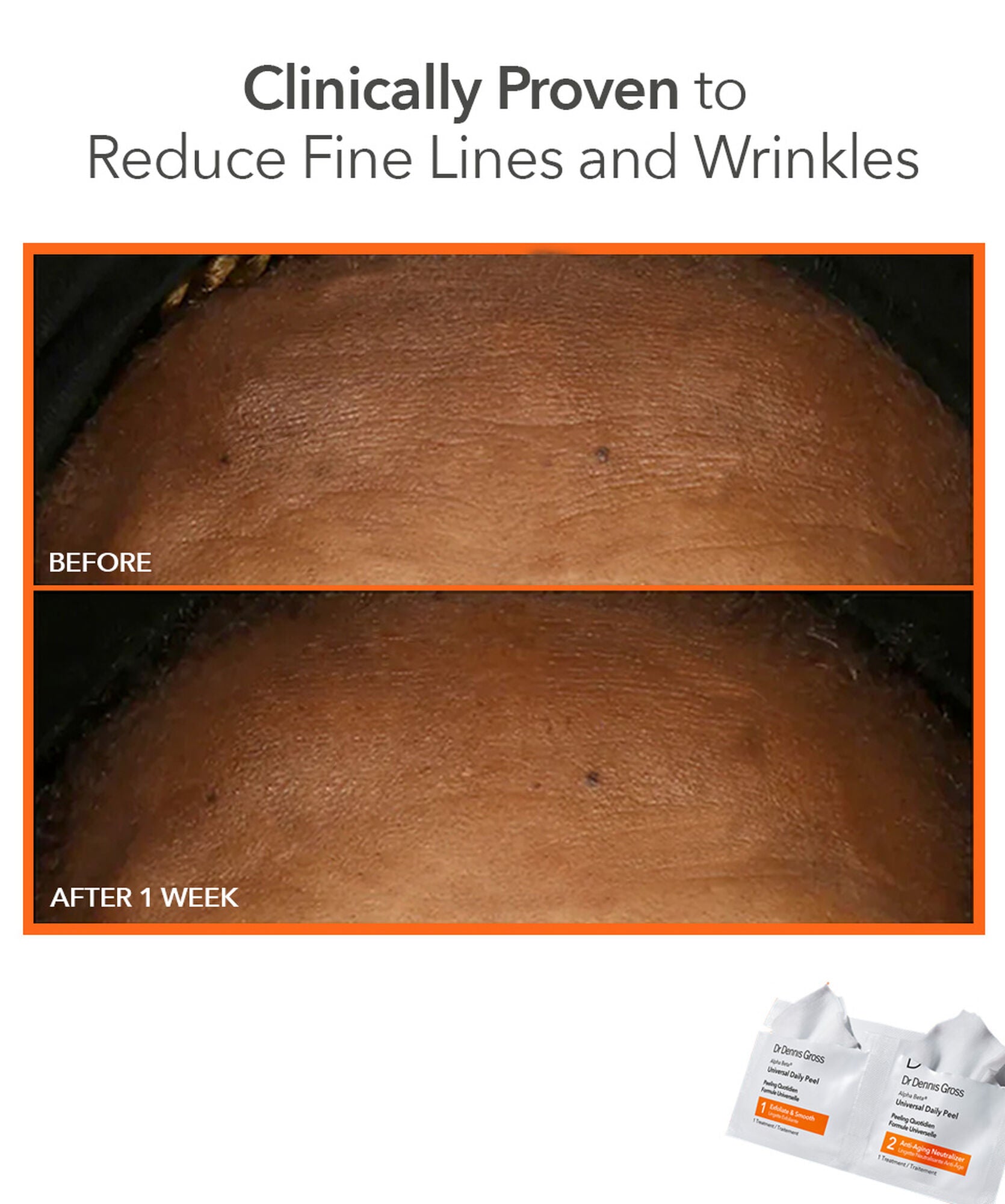 Dr Dennis Gross Alpha Beta Universal Daily Peel 30pk - www.Hudonline.no