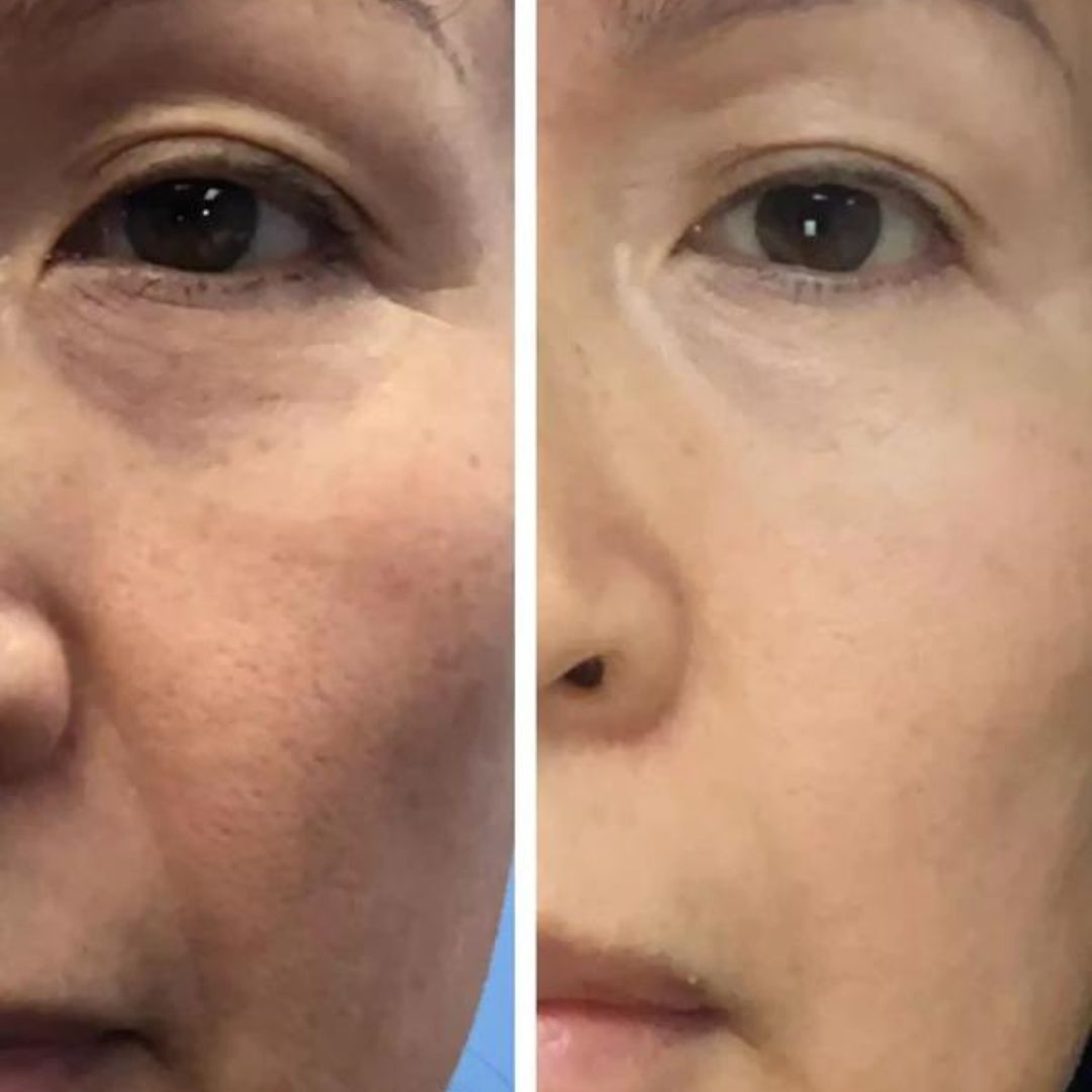 Emani Sleep & Renew Serum - www.Hudonline.no 