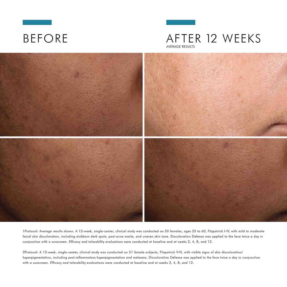 Skinceuticals Discoloration defense - www.Hudonline.no 