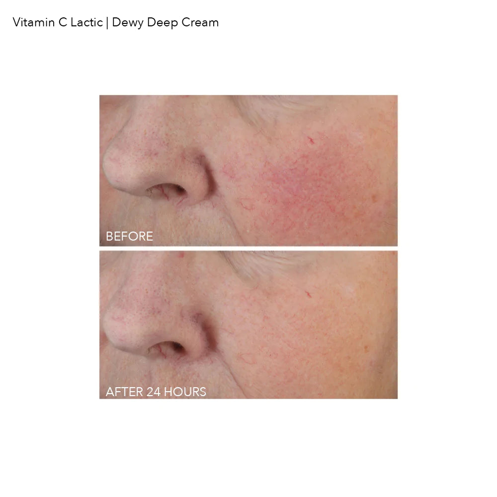 Dennis Gross Vitamin C + Lactic Dewy Deep Cream - www.Hudonline.no 