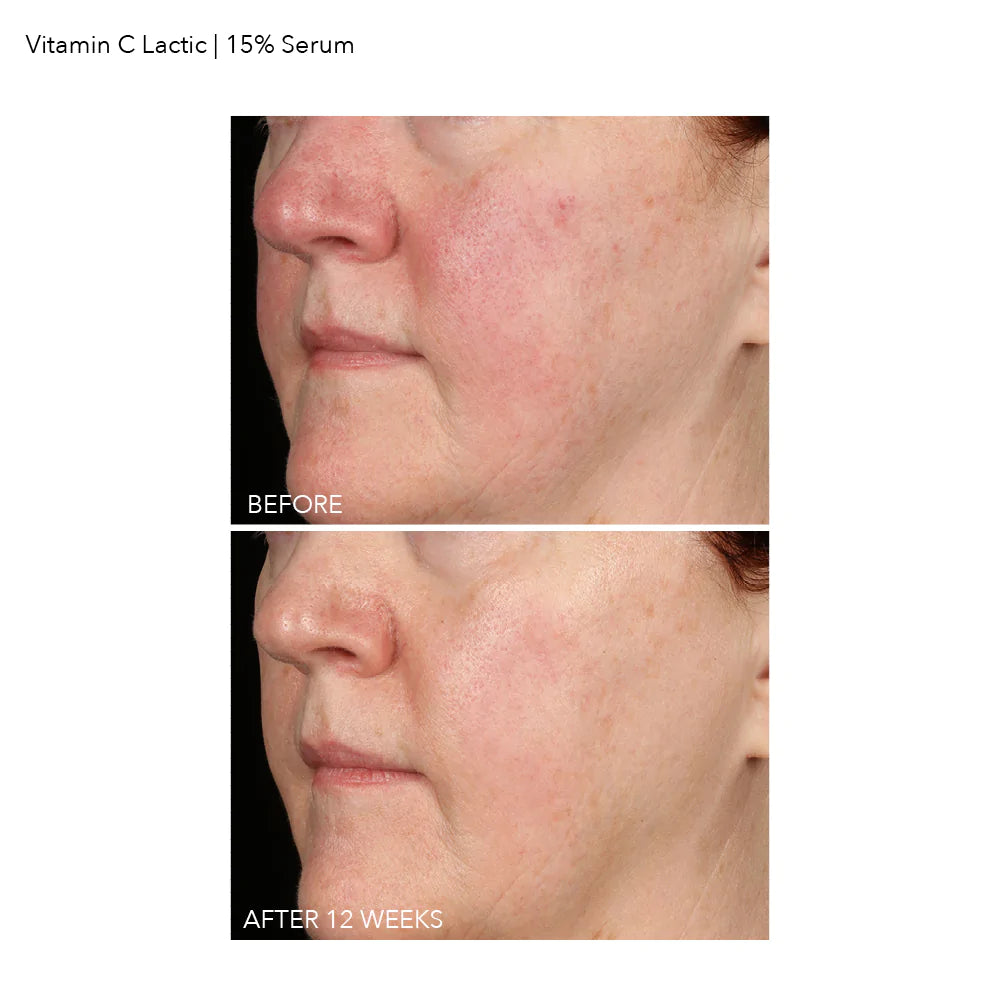 Dennis Gross 15% vitamin c firm & bright serum - www.Hudonline.no 
