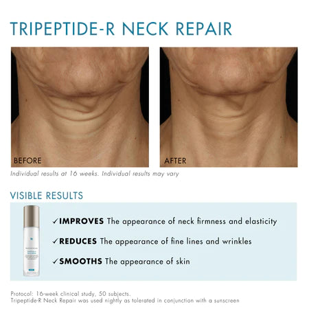 Skinceuticals Tripeptide r neckrepair - www.Hudonline.no 